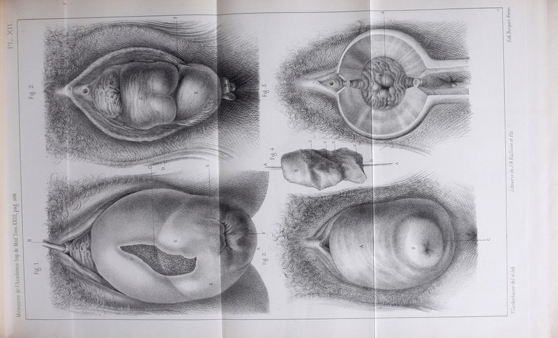 P.Lackerlauer del etlüh. Librairie de J.B.Baillièré et fih. £iè.Becjûei§eres.