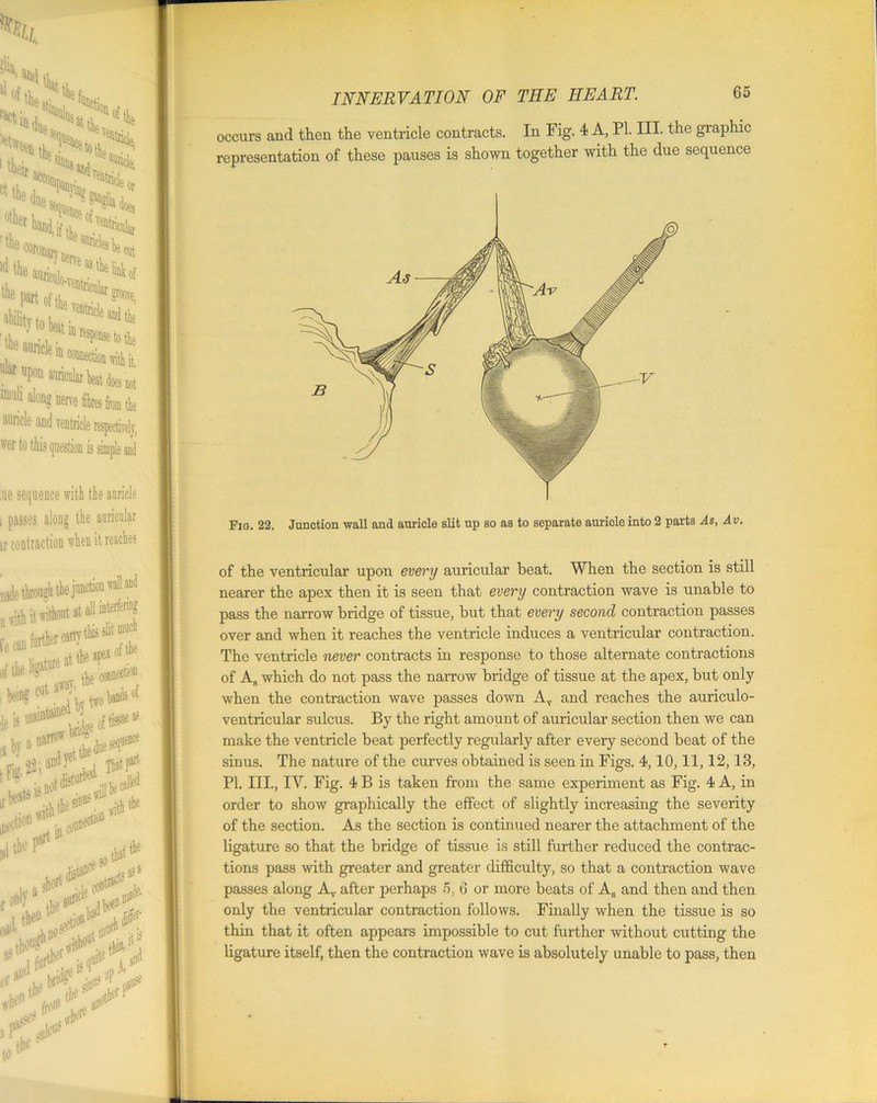 icte respectively, 'er to this question is simple and .ue sequence with the auricle i passes along the auricular H contraction when it reaches INNERVATION OF THE HEART. occurs and then the ventricle contracts. In Fig. 4 A, PI. III. the graphic representation of these pauses is shown together with the due sequence Fig. 22. Junction wall and auricle slit up so as to separate auricle into 2 parts As, Av. of the ventricular upon every auricular beat. When the section is still nearer the apex then it is seen that every contraction wave is unable to pass the narrow bridge of tissue, but that every second contraction passes over and when it reaches the ventricle induces a ventricular contraction. The ventricle never contracts in response to those alternate contractions of As which do not pass the narrow bridge of tissue at the apex, but only when the contraction wave passes down Av and reaches the auriculo- ventricular sulcus. By the right amount of auricular section then we can make the ventricle beat perfectly regularly after every second beat of the sinus. The nature of the curves obtained is seen in Figs. 4,10,11,12,13, PI. III., IY. Fig. 4 B is taken from the same experiment as Fig. 4 A, in order to show graphically the effect of slightly increasing the severity of the section. As the section is continued nearer the attachment of the ligature so that the bridge of tissue is still further reduced the contrac- tions pass with greater and greater difficulty, so that a contraction wave passes along Av after perhaps 5, 6 or more heats of AB and then and then only the ventricular contraction follows. Finally when the tissue is so thin that it often appears impossible to cut further without cutting the ligature itself, then the contraction wave is absolutely unable to pass, then