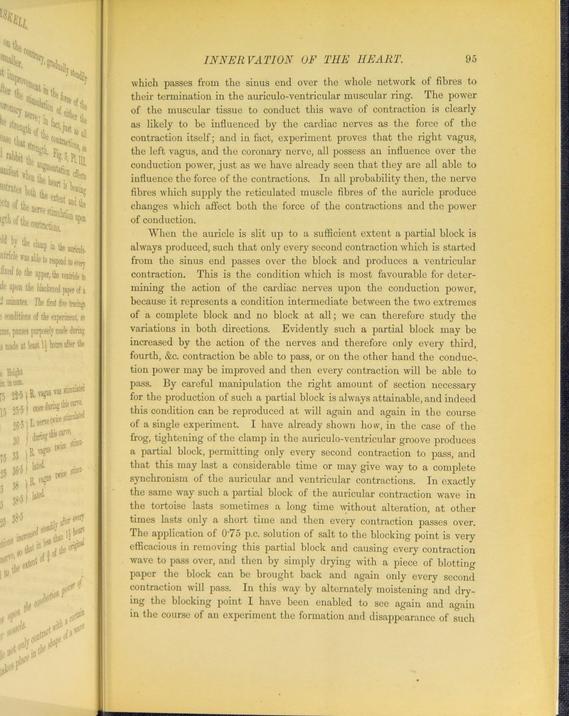 N :°r0narT Htj0n of ?* 1 ^ Dcrv&. ■ Either n eSl4'of?^MisaJ ***•»£?* ?1^y the damp b the amicttb. lifncle was able to respond to erery ^tc fa upper, the ventricle t ife upon the blactened paper of 2 minutes. Tie firrf fim t«™ i conditions of tie so lms, s e Height in. in mm. |5 22-5 \ R. vagus was s u 25-5i 1 WL-?** cnrre. jS 33 V?** 5 38 |R' 7 #*)&*■ tf 33'5 shiiio- ,,•1, afterert(7 tedst ^ ilb# tint the onH if tit Jt- f- *$>* which passes from the sinus end over the whole network of fibres to their termination in the auriculo-ventricular muscular ring. The power of the muscular tissue to conduct this wave of contraction is clearly as likely to be influenced by the cardiac nerves as the force of the contraction itself; and in fact, experiment proves that the right vagus, the left vagus, and the coronary nerve, all possess an influence over the conduction power, just as we have already seen that they are all able to influence the force of the contractions. In all probability then, the nerve fibres which supply the reticulated muscle fibres of the auricle produce changes which affect both the force of the contractions and the power of conduction. When the auricle is slit up to a sufficient extent a partial block is always produced, such that only every second contraction which is started from the sinus end passes over the block and produces a ventricular contraction. This is the condition which is most favourable for deter- mining the action of the cardiac nerves upon the conduction power, because it represents a condition intermediate between the two extremes of a complete block and no block at all; we can therefore study the variations in both directions. Evidently such a partial block may be increased by the action of the nerves and therefore only every third, fourth, &c. contraction be able to pass, or on the other hand the conduc- tion power may be improved and then every contraction will be able to pass. By careful manipulation the right amount of section necessary for the production of such a partial block is always attainable, and indeed this condition can be reproduced at will again and again in the course of a single experiment. I have already shown how, in the case of the frog, tightening of the clamp in the auriculo-ventricular groove produces a partial block, permitting only every second contraction to pass, and that this may last a considerable time or may give way to a complete synchronism of the auricular and ventricular contractions. In exactly the same way such a partial block of the auricular contraction wave in the tortoise lasts sometimes a long time without alteration, at other times lasts only a short time and then every contraction passes over. The application of 075 p.c. solution of salt to the blocking point is very efficacious in removing this partial block and causing every contraction wave to pass over, and then by simply drying with a piece of blotting paper the block can be brought back and again only every second contraction will pass. In this way by alternately moistening and dry- ing the blocking point I have been enabled to see again and again in the course of an experiment the formation and disappearance of such
