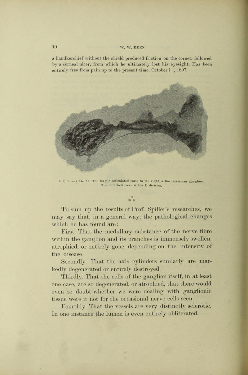 a handkerchief without the shield produced friction on the cornea followed by a corneal ulcer, from which he ultimately lost his eyesight. Has been entirely free from pain up to the present time, October 1 , 1807. Fig. 7. — Case XI. The larger reticulated mass to the right is the Gasserian ganglion. The detached piece is the II division. * * * To sum up the results of Prof. Spiller’s researches, we may say that, in a general way, the pathological changes which he has found are: First. That the medullary substance of the nerve fibre within the ganglion and its branches is immensely swollen, atrophied, or entirely gone, depending on the intensity of the disease Secondly. That the axis cylinders similarly are mar- kedly degenerated or entirely destroyed. Thirdly. That the cells of the ganglion itself, in at least one case, are so degenerated, or atrophied, that there would even be doubt whether we were dealing with ganglionic tissue were it not for the occasional nerve cells seen. Fourthly. That the vessels are very distinctly sclerotic. In one instance the lumen is even entirely obliterated.