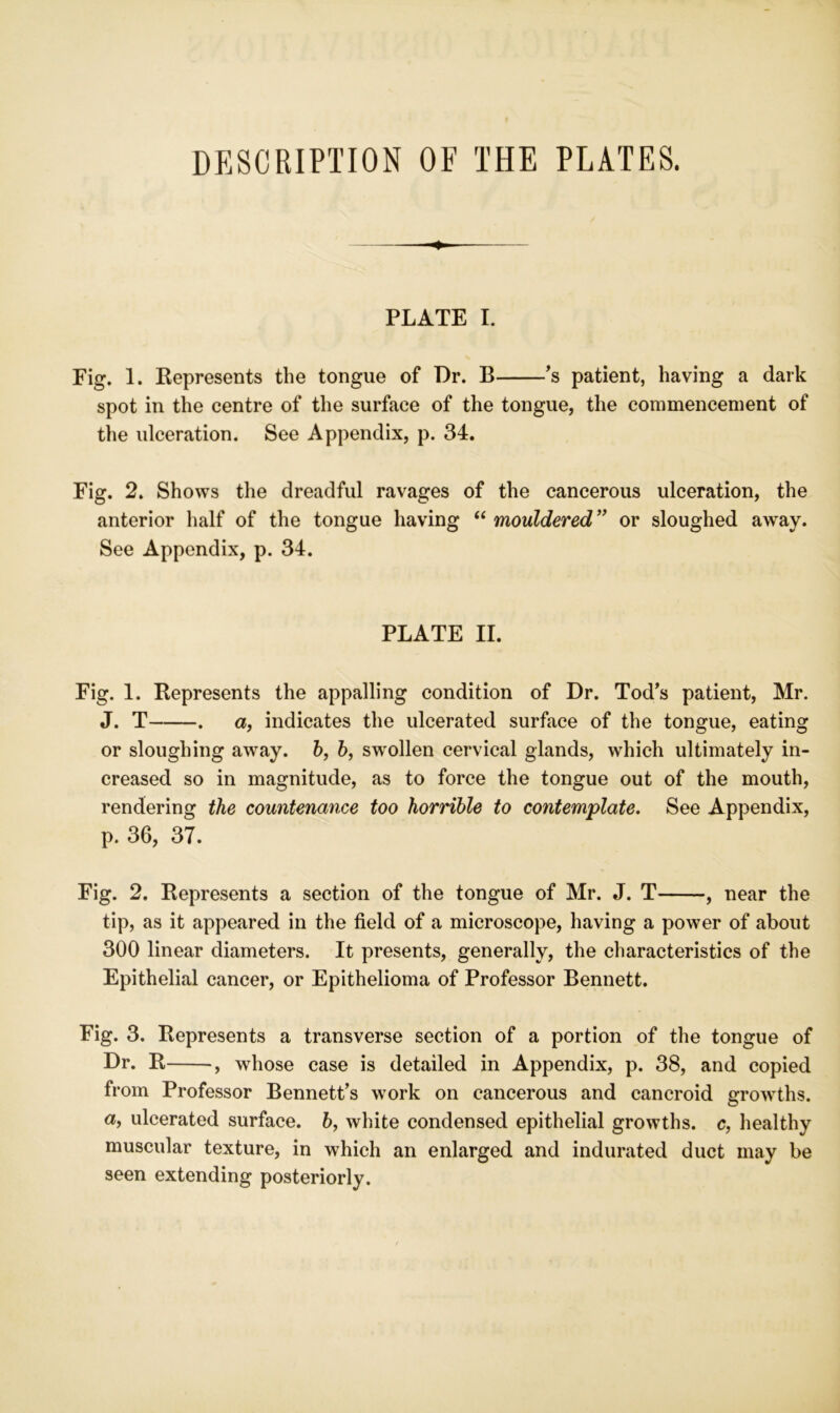 DESCRIPTION OF THE PLATES. PLATE I. Fig. 1. Eepresents the tongue of Dr. B s patient, having a dark spot in the centre of the surface of the tongue, the commencement of the ulceration. See Appendix, p. 34. Fig. 2. Shows the dreadful ravages of the cancerous ulceration, the anterior half of the tongue having “ mouldered*’ or sloughed away. See Appendix, p. 34. PLATE II. Fig. 1. Represents the appalling condition of Dr. Tod’s patient, Mr. J. T . a, indicates the ulcerated surface of the tongue, eating or sloughing away. 6, h, swollen cervical glands, which ultimately in- creased so in magnitude, as to force the tongue out of the mouth, rendering the countenance too horrible to contemplate. See Appendix, p. 36, 37. Fig. 2. Represents a section of the tongue of Mr. J. T , near the tip, as it appeared in the field of a microscope, having a power of about 300 linear diameters. It presents, generally, the characteristics of the Epithelial cancer, or Epithelioma of Professor Bennett. Fig. 3. Represents a transverse section of a portion of the tongue of Dr. R , whose case is detailed in Appendix, p. 38, and copied from Professor Bennett’s wmrk on cancerous and cancroid growths, a, ulcerated surface. 6, white condensed epithelial growths, c, healthy muscular texture, in which an enlarged and indurated duct may be seen extending posteriorly.