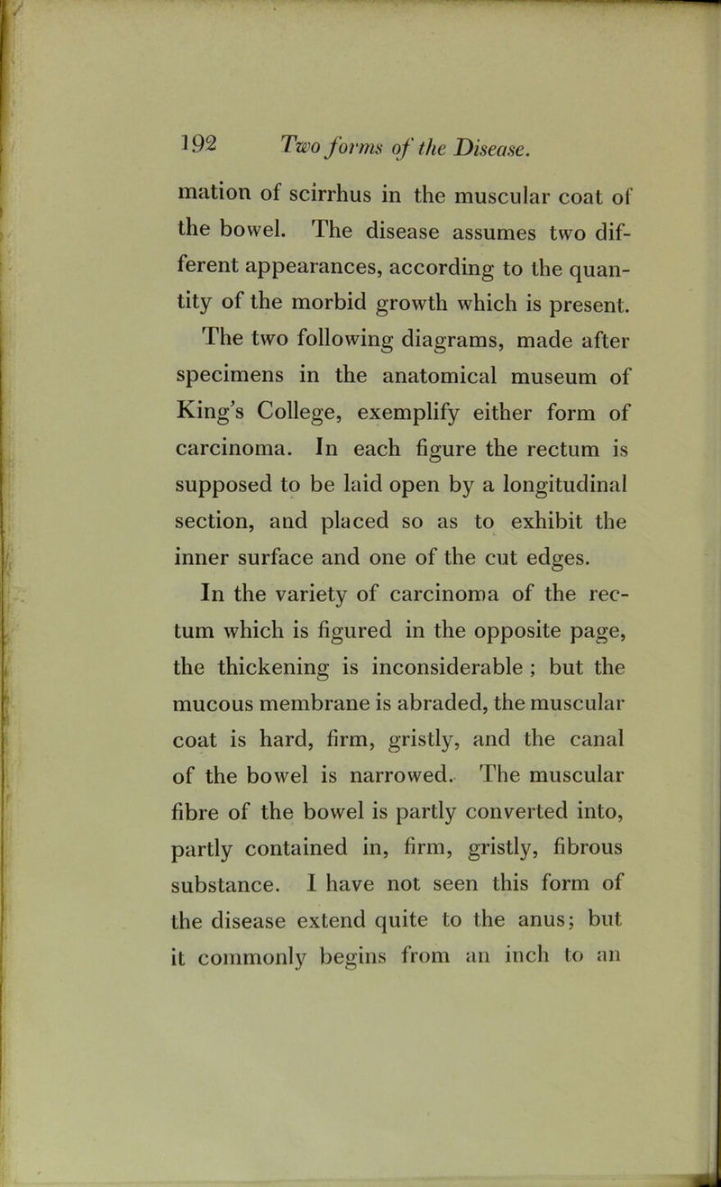 mation of scirrhus in the muscular coat of the bowel. The disease assumes two dif- ferent appearances, according to the quan- tity of the morbid growth which is present. The two following diagrams, made after specimens in the anatomical museum of King's College, exemplify either form of carcinoma. In each figure the rectum is supposed to be laid open by a longitudinal section, and placed so as to exhibit the inner surface and one of the cut edges. In the variety of carcinoma of the rec- tum which is figured in the opposite page, the thickening is inconsiderable ; but the mucous membrane is abraded, the muscular coat is hard, firm, gristly, and the canal of the bowel is narrowed. The muscular fibre of the bowel is partly converted into, partly contained in, firm, gristly, fibrous substance. I have not seen this form of the disease extend quite to the anus; but it commonly begins from an inch to an