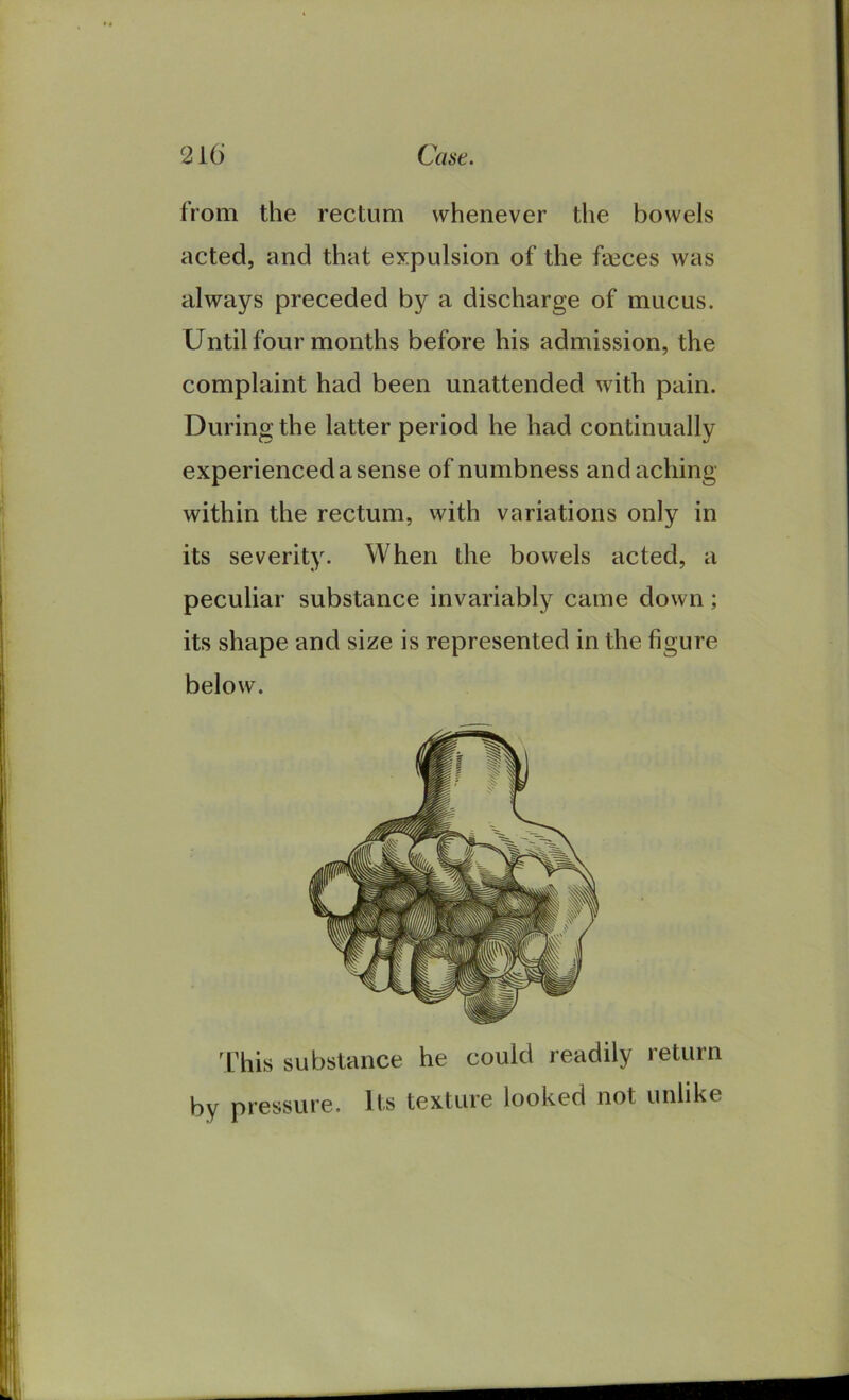 from the rectum whenever the bowels acted, and that expulsion of the feeces was always preceded by a discharge of mucus. Until four months before his admission, the complaint had been unattended with pain. During the latter period he had continually experienced a sense of numbness and aching within the rectum, with variations only in its severity. When the bowels acted, a peculiar substance invariably came down ; its shape and size is represented in the figure below. This substance he could readily return by pressure. Its texture looked not unlike