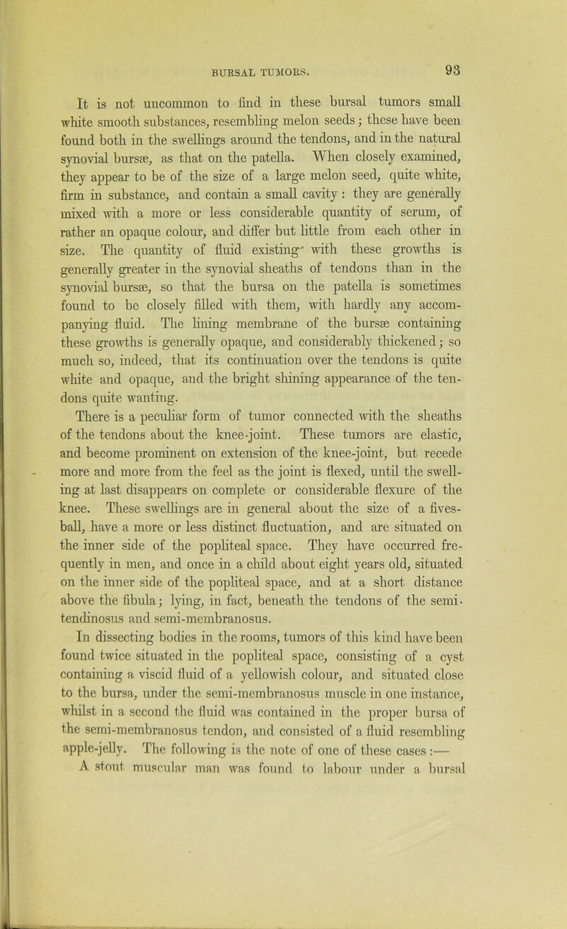 It is not uncommon to lind in these bursal tumors small white smooth substances, resembhng melon seeds; these have been found both in the sweUiugs around the tendons, and in the natural synovial hru'sae, as that on the patella. When closely examined, they appeal- to be of the size of a large melon seed, quite white, firm in substance, and contain a small cavity : they are generally mixed with a more or less considerable quantity of serum, of rather an opaque colour, and differ but little from each other in size. The quantity of fluid existing-' with these growths is generally greater in the synovial sheaths of tendons than in the synovial bursae, so that the bursa on the patella is sometimes found to be closely filled vdth them, with hardly any accom- panying fluid. The huing membrane of the bursae containing these gi-owths is generally opaque, and considerably thickened; so much so, indeed, tliat its continuation over the tendons is quite white and opaque, and the bright sliining appearance of the ten- dons quite wanting. There is a pecuhar form of tumor connected -with the sheaths of the tendons about the knee-joint. These tumors are elastic, and become prominent on extension of the knee-joint, but recede more and more from the feel as the joint is flexed, until the swell- ing at last disappears on complete or considerable flexure of the knee. These sweUings are in general about the size of a fives- ball, have a more or less distinct fluctuation, and are situated on the inner side of the popliteal space. They have occurred fre- quently in men, and once in a cliild about eight years old, situated on the inner side of the popliteal space, and at a short distance above the fibula; lying, in fact, beneath the tendons of the semi- tendinosus and semi-membranosus. In dissecting bodies in tire rooms, tumors of this kind have been found twice situated in the popliteal space, consisting of a cyst containing a viscid fluid of a yellowish colour, and situated close to the bursa, imder the semi-membranosus muscle in one instance, whilst in a second the fluid was contained in the proper bursa of the semi-membranosus tendon, and consisted of a fluid resembling apple-jeUy. The following is the note of one of these cases :— A. stout muscular man was found to labour under a bursal
