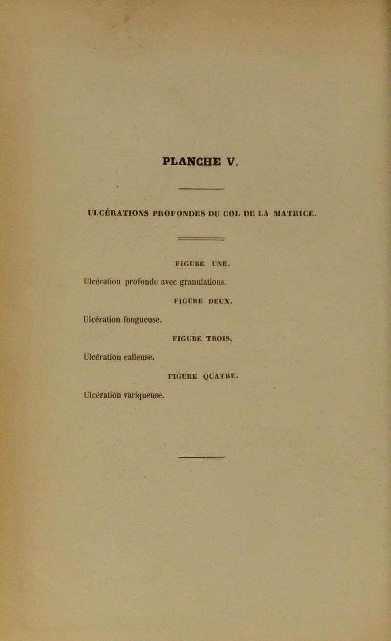 ULGÉRATIOKS PROFONDES DR COL DE LA MATRICE. FIGUUE RIME. Ulcération profonde avec granulations. FIGURE DEUX. Ulcération fongueuse. FIGURE TROIS. Ulcération calleuse. FIGURE QUATRE. Ulcération variqueuse.