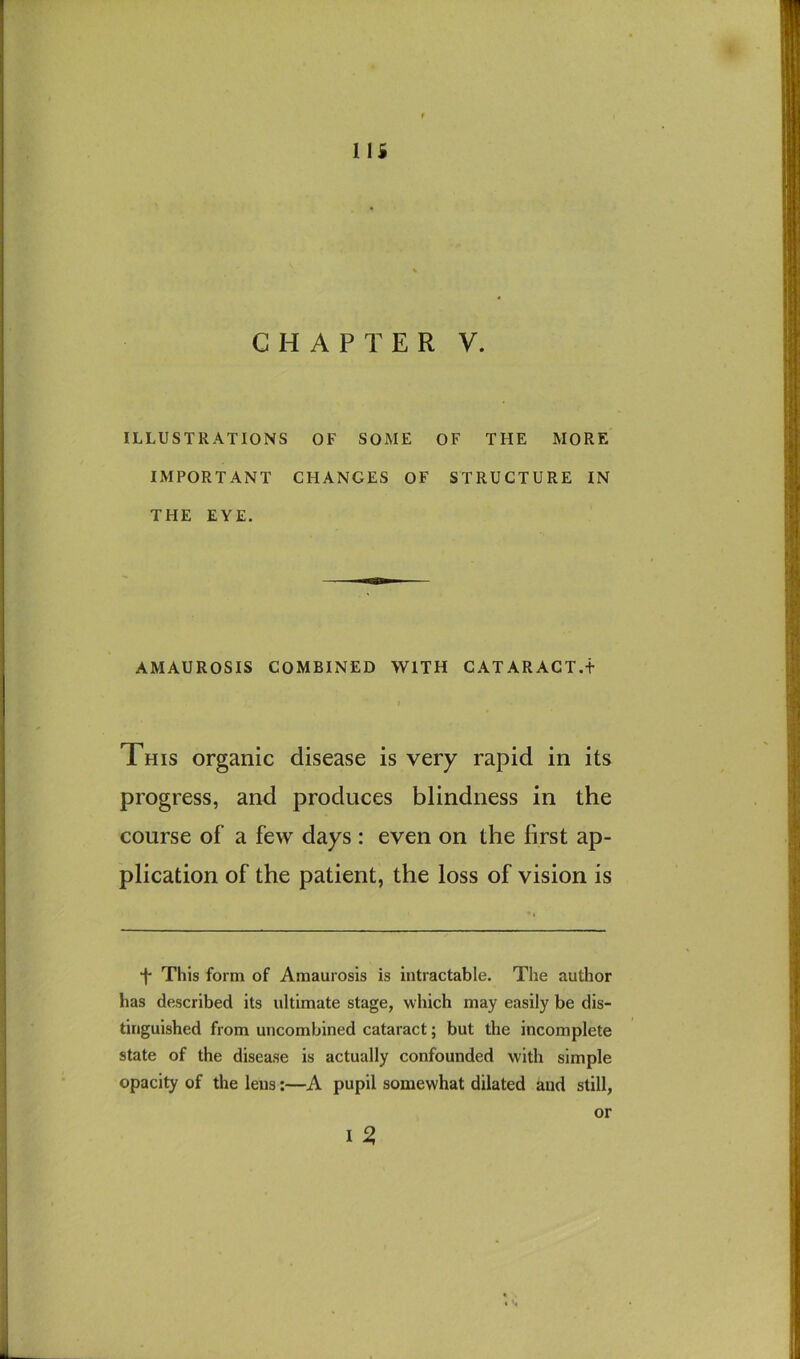 CHAPTER V. ILLUSTRATIONS OF SOME OF THE MORE IMPORTANT CHANGES OF STRUCTURE IN THE EYE. AMAUROSIS COMBINED WITH CATARACT.t t This organic disease is very rapid in its progress, and produces blindness in the course of a few days : even on the first ap- plication of the patient, the loss of vision is •f* This form of Amaurosis is intractable. The author has described its ultimate stage, which may easily be dis- tinguished from uncombined cataract; but the incomplete state of the disease is actually confounded with simple opacity of the lens;—A pupil somewhat dilated aud still, I ^ or