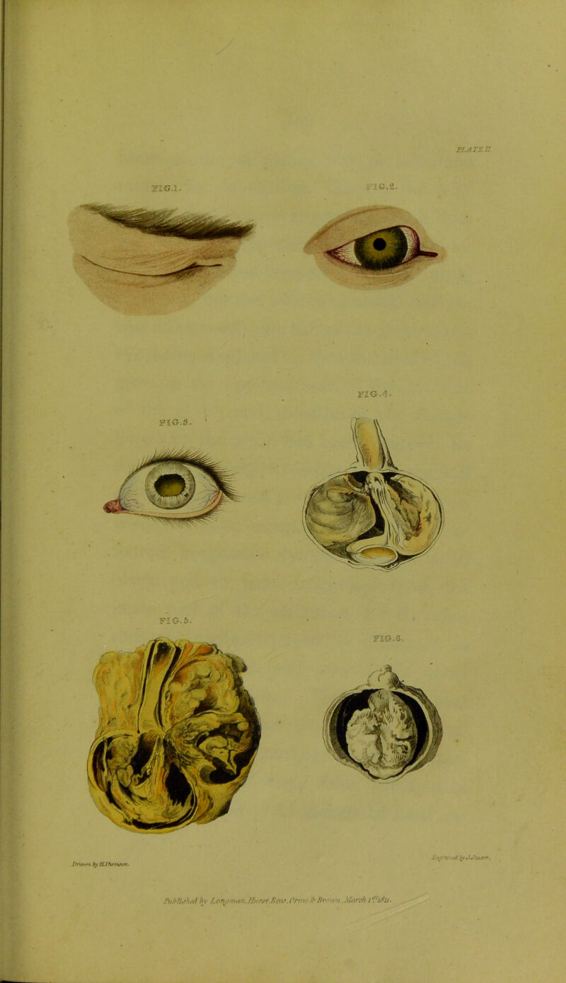 rt.ATsn yiG.l. i-lG.‘Z. fIG.4. FIG.6. hiblUhttI hy Lononum flnnfi fict\f.Ornu'.'b n. Miin-Ji ti'i/fu.