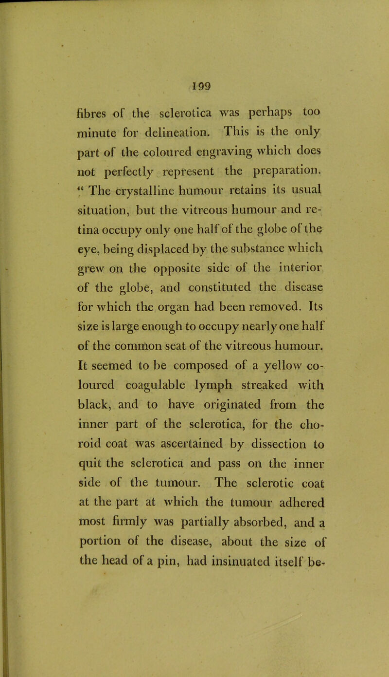 fibres of the sclerotica was perhaps too minute for delineation. This is the only part of the coloured engraving which does not perfectly represent the preparation. “ The crystalline humour retains its usual situation, but the vitreous humour and re- tina occupy only one half of the globe of the eye, being displaced by the substance which grew on the opposite side of the interior of the globe, and constituted the disease for which the organ had been removed. Its size is large enough to occupy nearly one half of the common seat of the vitreous humour. It seemed to be composed of a yellow co- loured coagulable lymph streaked with black, and to have originated from the inner part of the sclerotica, for the cho- roid coat was ascertained by dissection to quit the sclerotica and pass on the inner side of the tumour. The sclerotic coat at the part at which the tumour adhered most firmly was partially absorbed, and a portion of the disease, about the size of the head of a pin, had insinuated itself be-