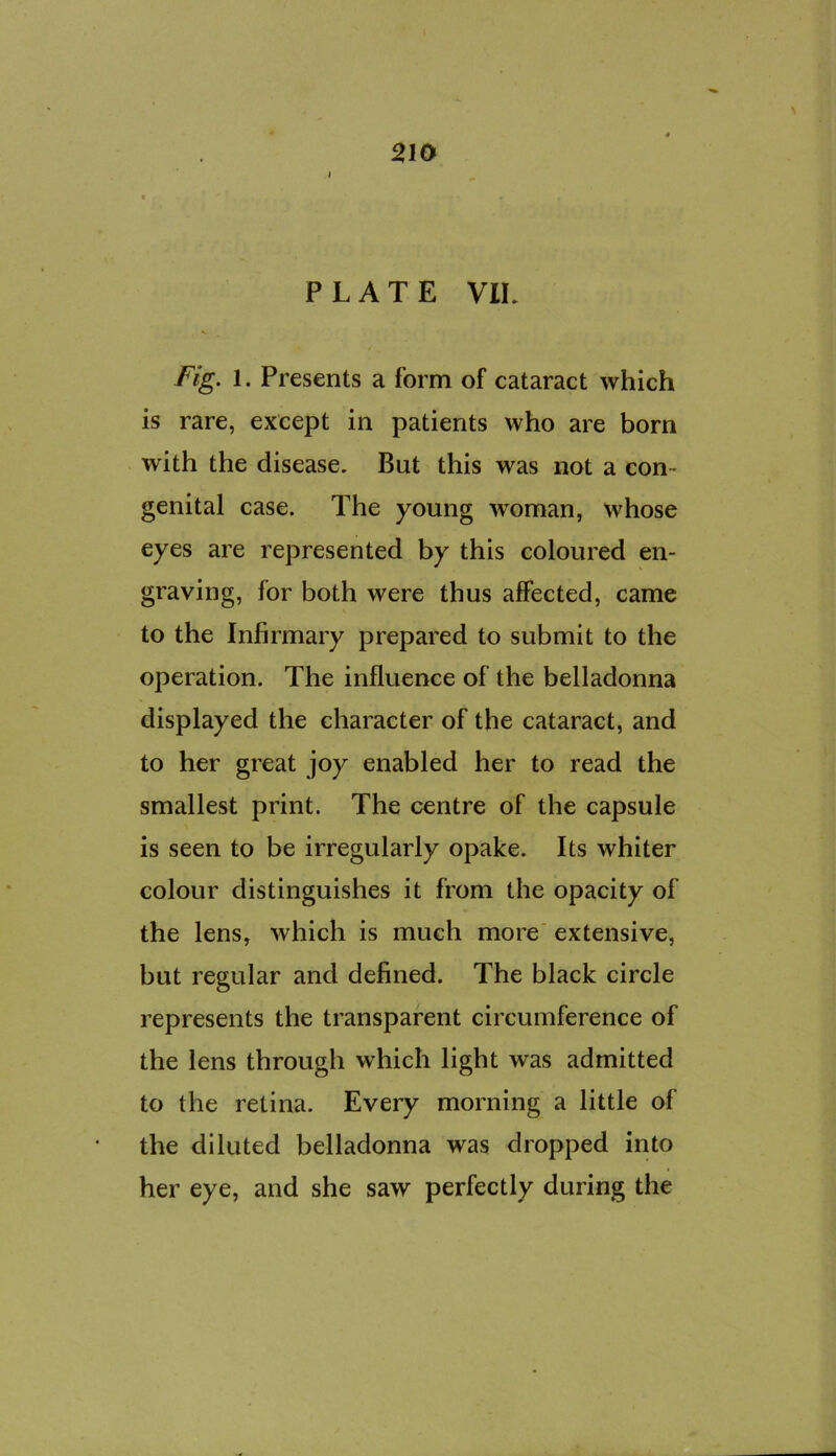 210 PLATE VIL Ftg. 1. Presents a form of cataract which is rare, except in patients who are born with the disease. But this was not a con- genital case. The young woman, whose eyes are represented by this coloured en- graving, for both were thus affected, came to the Infirmary prepared to submit to the operation. The influence of the belladonna displayed the character of the cataract, and to her great joy enabled her to read the smallest print. The centre of the capsule is seen to be irregularly opake. Its whiter colour distinguishes it from the opacity of the lens, which is much more' extensive, but regular and defined. The black circle represents the transparent circumference of the lens through which light was admitted to the retina. Every morning a little of the diluted belladonna was dropped into her eye, and she saw perfectly during the