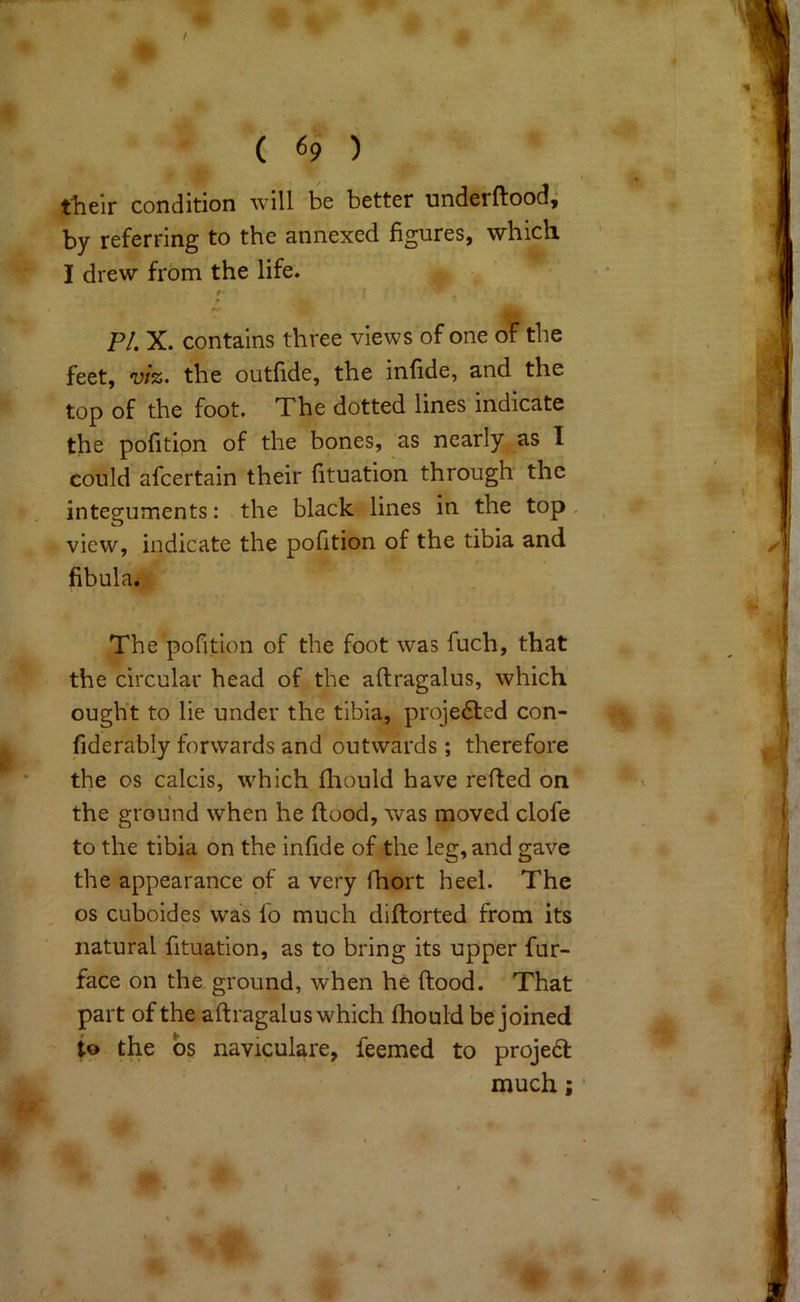 t u r.\ % t^ieir condition will be better underftood^ by referring to the annexed figures, which I drew from the life. f PI. X. contains three views of one of the feet, viz. the outfide, the infide, and the top of the foot. The dotted lines indicate the pofitipn of the bones, as nearly as I could afcertain their fituation through the integuments: the black lines in the top, ^ view, indicate the pofition of the tibia and fibula. The pofition of the foot was fuch, that the circular head of the aftragalus, which ought to lie under the tibia, projected con- fiderably forwards and outwards; therefore the os calcis, which fliould have refted on the ground when he flood, was moved clofe to the tibia on the infide of the leg, and gave the appearance of a very fhort heel. The os cuboides was fo much diftorted from it's ' natural fituation, as to bring its upper fur- face,on the,ground, when he flood. That ' ►' f' part of the aftragalus which fhould be joined ip the bs naviculare, leemed to projeft f much; • ( «9 )