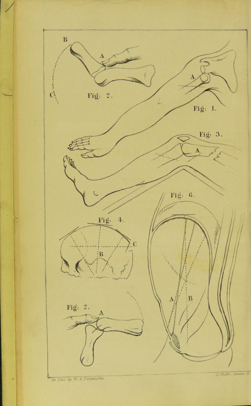 ’^'ZiKC iy W A.VRtMrwUe. C. Ohah~. Skv/iir St