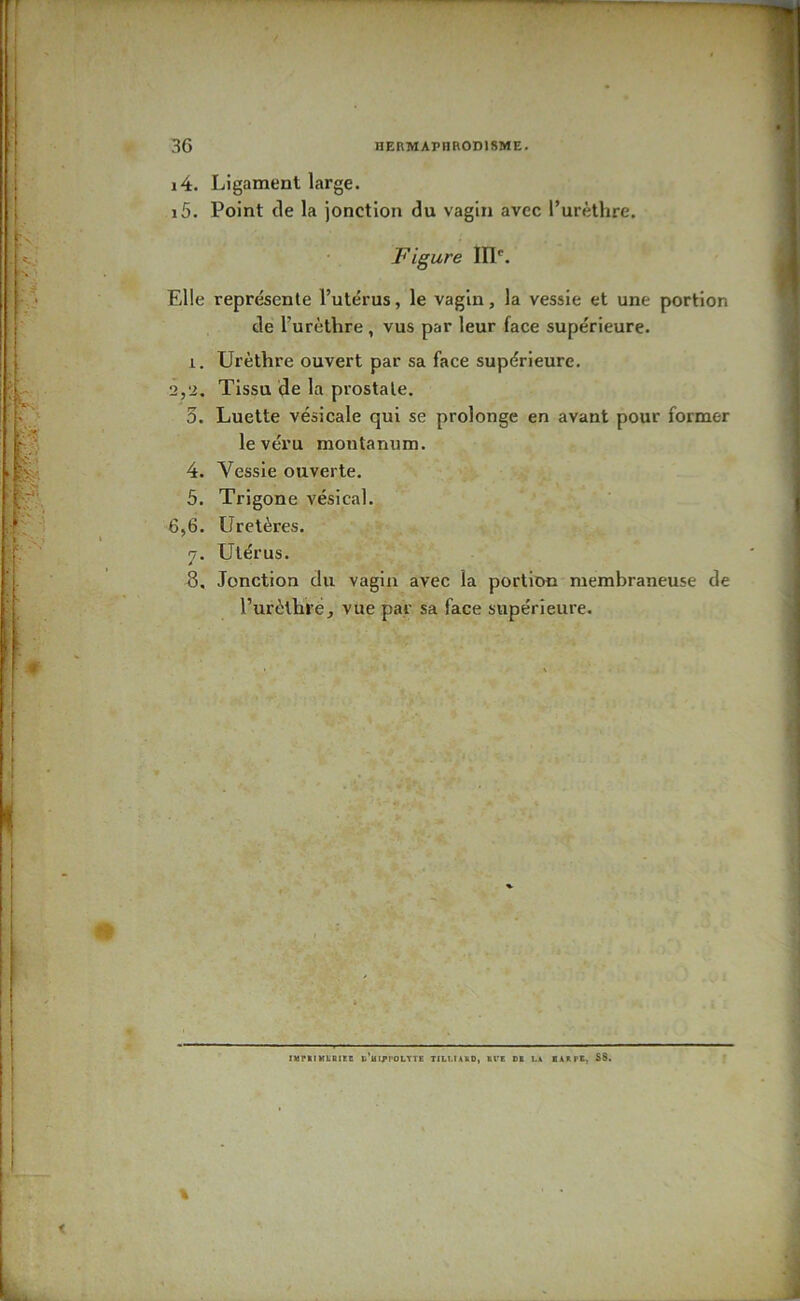 CO 36 HERMAPHRODISME. 14. Ligament large. 15. Point de la jonction du vagin avec l’urèthre. Figure III'. Elle représente l’utérus, le vagin, la vessie et une portion de l’urèthre, vus par leur face supérieure. 1. Urèthre ouvert par sa face supérieure. 2,2. Tissu de la prostate. 3. Luette vésicale qui se prolonge en avant pour former levéru montanum. 4. Vessie ouverte. 5. Trigone vésical. 6,6. Uretères. . Utérus. , Jonction du vagin avec la portion membraneuse de l’urèthré, vue par sa face supérieure. IMrKIMLBlKe C’UIPPOLTTE TILUAIO, tVE DI LA lARPE, S8.