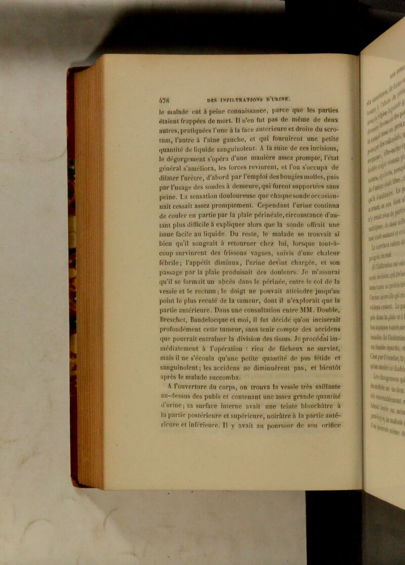 /|7S DF.9 TXFIT.TR ATI0N9 d’URIHF. le malade eut à peine connaissance, parce que les parties étaient frappées de mort. Il n’en fut pas de même de deux autres, pratiquées l’une à la face antérieure et droite du scro- tum, l’autre à l’aine gauche, et qui fournirent une petite quantité de liquide sanguinolent. A la suite de ces incisions, le dégorgement s’opéra d’une manière assez prompte, l’état général s’améliora, les forces revinrent, et l’on s’occupa de dilater l’urètre, d’abord par l’emploi des bougies molles, puis par l’usage des sondes à demeure,qui furent supportées sans peine. La sensation douloureuse que chaque sonde occasion- nait cessait assez promptement. Cependant l’urine continua de couler en partie par la plaie périnéale, circonstance d’au- tant plus difficile à expliquer alors que la sonde offrait une issue facile au liquide. Du reste, le malade se trouvait si bien qu’il songeait à retourner chez lui, lorsque tout-à- coup survinrent des frissons vagues, suivis d’une chaleur fébrile; l’appétit diminua, l’urine devint chargée, et son passage par la plaie produisait des douleurs. Je m’assurai qu’il se formait un abcès dans le périnée, entre le col de la vessie cl le rectum ; le doigt ne pouvait atteindre jusqu’au point le plus reculé de la tumeur, dont il n’explorait que la partie antérieure. Dans une consultation entre MM. Double, Breschct, Baudelocque et moi, il fut décidé qu’on inciserait profondément cette tumeur, sans tenir compte des accidens » que pourrait entraîner la division des tissus. Je procédai im- médiatement à l’opération : rien de fâcheux ne survint, mais il ne s’écoula qu’une petite quantité de pus fétide et sanguinolent ; les accidens ne diminuèrent pas, et bientôt après le malade succomba. A l’ouverture du corps, on trouva la vessie très saillante au-dessus des pubis et contenant une assez grande quantité d’urine ; sa surface interne avait une teinte blanchâtre à la partie postérieure et supérieure, noirâtre à la partie anté- rieure et inférieure. Il y avait au pourtour de son orifice
