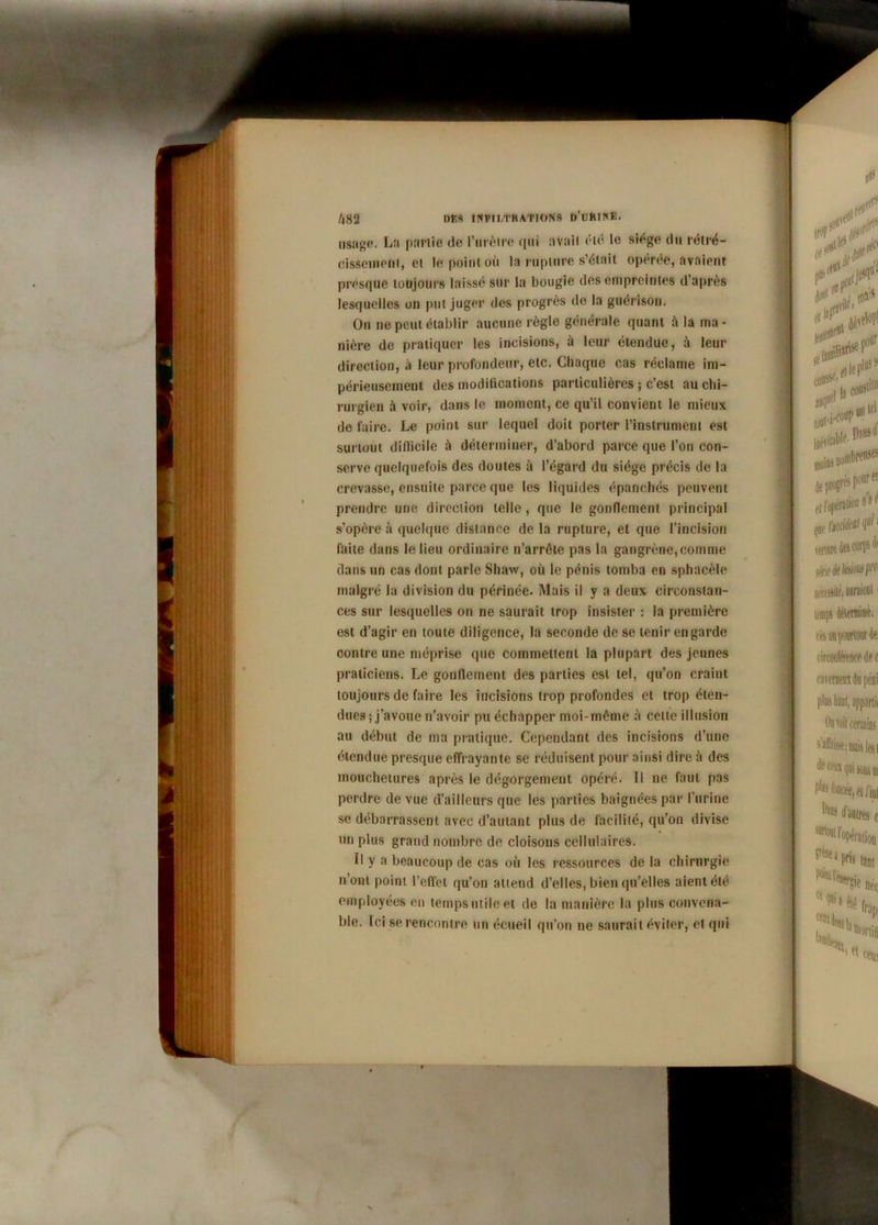 usage. La partie de l'urètre qui avait été le siège du rétré- cissement, et le point où la rupture s’était opérée, avaient presque toujours laissé sur la bougie des empreintes d’après lesquelles on put juger des progrès de la guérison. On ne peut établir aucune règle générale quant à la ma- nière de pratiquer les incisions, à leur étendue, à leur direction, à leur profondeur, etc. Chaque cas réclame im- périeusement des modifications particulières ; c’est au chi- rurgien à voir, dans le moment, ce qu’il convient le mieux de faire. Le point sur lequel doit porter l'instrument est surtout difficile à déterminer, d’abord parce que l’on con- serve quelquefois des doutes à l’égard du siège précis de la crevasse, ensuite parce que les liquides épanchés peuvent prendre une direction telle , que le gonflement principal s’opère à quelque distance de la rupture, et que l’incision faite dans le lieu ordinaire n’arrête pas la gangrène,comme dans un cas dont parle Sliaw, où le pénis tomba en sphacèlo malgré la division du périnée. Mais il y a deux circonstan- ces sur lesquelles on ne saurait trop insister : la première est d’agir en toute diligence, la seconde de se tenir en garde contre une méprise que commettent la plupart des jeunes praticiens. Le gonflement des parties est tel, qu’on craint toujours de faire les incisions trop profondes et trop éten- dues ; j’avoue n’avoir pu échapper moi-même à celle illusion au début de ma pratique. Cependant des incisions d’une étendue presque effrayante se réduisent pour ainsi dire à des mouchetures après le dégorgement opéré. Il ne faut pas perdre de vue d’ailleurs que les parties baignées par l’urine se débarrassent avec d’autant plus de facilité, qu’on divise un plus grand nombre de cloisons cellulaires. Il y a beaucoup de cas où les ressources de la chirurgie n’ont point l’effet qu’on attend d’elles, bien qu’elles aient été employées en temps utile et de la manière la plus convena- ble. Ici se rencontre un écueil qu’on ne saurait éviter, et qui