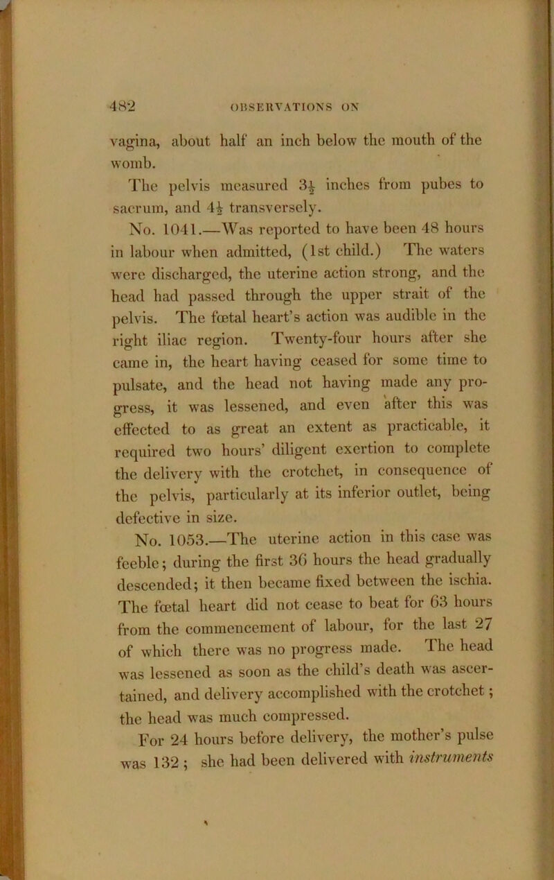 vagina, about half an inch below the mouth of the womb. The pelvis measured 3| inches from pubes to sacrum, and 4^ transversely. No. 1041.—Was reported to have been 48 hours in labour when admitted, (1st child.) The waters were discharged, the uterine action strong, and the head had passed through the upper strait of the pelvis. The foetal heart’s action was audible in the right iliac region. Twenty-four hours after she came in, the heart having ceased for some time to pulsate, and the head not having made any pro- gress, it was lessened, and even after this was effected to as great an extent as practicable, it required two hours’ diligent exertion to complete the delivery with the crotchet, in consequence of the pelvis, particularly at its inferior outlet, being defective in size. No. 1053.—The uterine action in this case was feeble; during the first 30 hours the head gradually descended; it then became fixed between the ischia. The foetal heart did not cease to beat for 03 hours from the commencement of labour, for the last 27 of which there was no progress made. The head was lessened as soon as the child s death was ascer- tained, and delivery accomplished with the crotchet; the head w^as much compressed. For 24 hours before delivery, the mother’s pulse was 132 ; she had been delivered with instruments