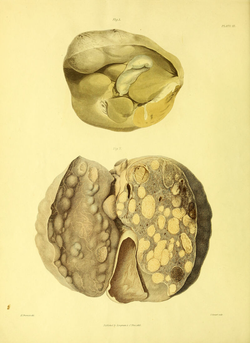 PLATE m. J.Stmwf sat^ • S.Thmnson dfl. Ficf.l. I\il>liFhcd by C.J\h'.jj6J3.