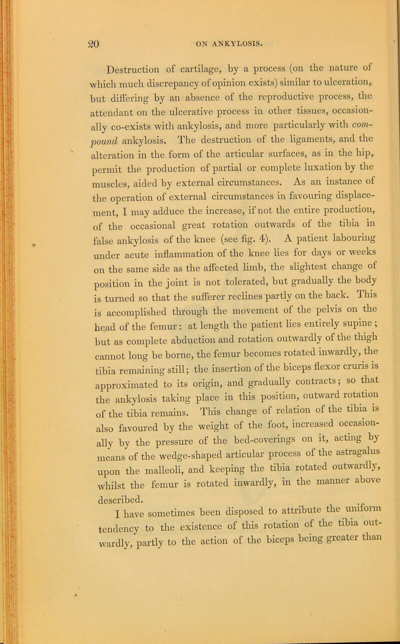 Destruction of cartilage, by a process (on the nature of which much discrepancy of opinion exists) similar to ulceration, but differing by an absence of the reproductive process, the attendant on the ulcerative process in other tissues, occasion- ally co-exists with ankylosis, and more particularly with com- pound ankylosis. The destruction of the ligaments, and the alteration in the form of the articular surfaces, as in the hip, permit the production of partial or complete luxation by the muscles, aided by external circumstances. As an instance of the operation of external circumstances in favouring displace- ment, I may adduce the increase, if not the entire production, of the occasional great rotation outwards of the tibia in false ankylosis of the knee (see fig. 4). A patient labouring under acute inflammation of the knee lies for days or weeks on the same side as the affected limb, the slightest change of position in the joint is not tolerated, but gradually the body is turned so that the sufferer reclines partly on the back. This is accomplished through the movement of the pelvis on the head of the femur; at length the patient lies entirely supine ; but as complete abduction and rotation outwardly of the thigh cannot long be borne, the femur becomes rotated inwardly, the tibia remaining still; the insertion of the biceps flexor crmds is approximated to its origin, and gradually contracts; so that the ankylosis taking place in this position, outward rotation of the tibia remains. This change of relation of the tibia is also favoured by the weight of the foot, increased occasion- ally by the pressure of the bed-coverings on it, acting by means of the wedge-shaped articular process of the astragalus upon the malleoli, and keeping the tibia rotated outwai-dly, whilst the femur is rotated inwardly, in the manner above described. I have sometimes been disposed to attribute the uniform tendency to the existence of this rotation of the tibia out- wardly, partly to the action of the biceps being greater than