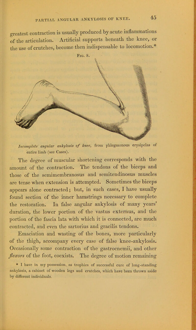 greatest contraction is usually produced by acute inflammations of the articulation. Artificial supports beneath the knee, or tlie use of crutches, become then indispensable to locomotion.* Fig. 8. Incomplete angular ankylosis of knee, from phlegmonous erysipelas of entire limb (see Cases). The degree of muscular shortening corresponds with the amount of the contraction. The tendons of the biceps and those of the semimembranosus and semitendinosus muscles are tense when extension is attempted. Sometimes the biceps appears alone contracted; but, in such cases, I have usually found section of the inner hamstrings necessary to complete the restoration. In false angular ankylosis of many years’ duration, the lower portion of the vastus externus, and the portion of the fascia lata with which it is connected, are much contracted, and even the sartorius and gracilis tendons. Emaciation and wasting of the bones, more particularly of the thigh, accompany every case of false knee-ankylosis. Occasionally some contraction of the gastrocnemii, and other flexors of the foot, coexists. The degree of motion remaining • I have in my possession, as trophies of successful cure of long-standing ankylosis, a cabinet of wooden legs and crutches, which have been thrown aside by different individuals.