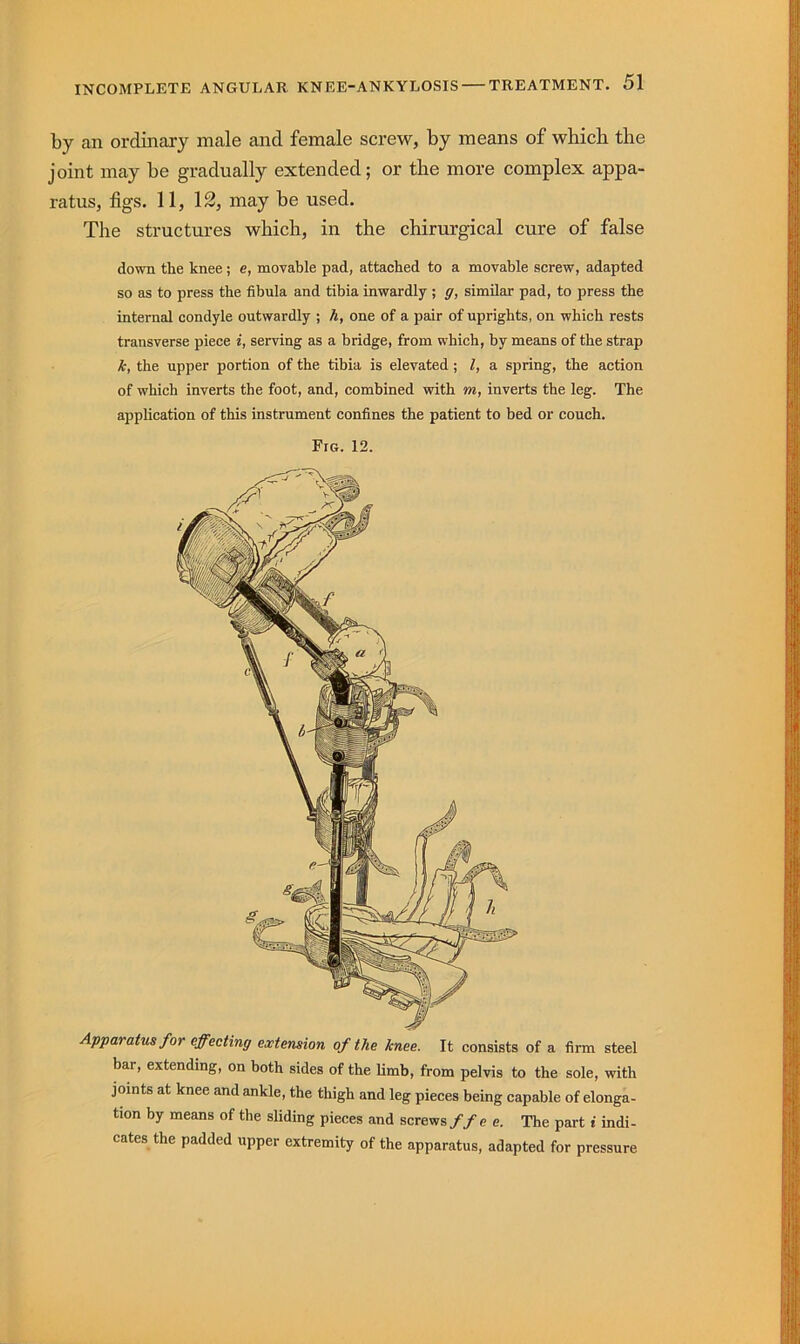 by an ordinary male and female screw, by means of which the joint may be gradually extended; or the more complex appa- ratus, figs. 11, 12, may be used. The structures which, in the chirurgical cure of false down the knee; e, movable pad, attached to a movable screw, adapted so as to press the fibula and tibia inwardly ; g, similar pad, to press the internal condyle outwardly ; h, one of a pair of uprights, on which rests transverse piece i, serving as a bridge, from which, by means of the strap k, the upper portion of the tibia is elevated; I, a spring, the action of which inverts the foot, and, combined with m, inverts the leg. The application of this instrument confines the patient to bed or couch. Fig. 12. Apparatus for effecting extension of the knee. It consists of a firm steel bar, extending, on both sides of the limb, from pelvis to the sole, with joints at knee and ankle, the thigh and leg pieces being capable of elonga- tion by means of the sliding pieces and screws ffee. The part i indi- cates the padded upper extremity of the apparatus, adapted for pressure