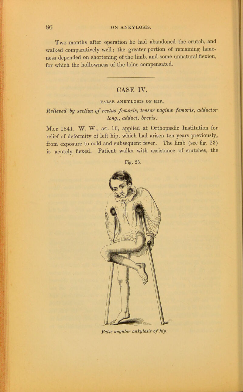 Two months after operation he had abandoned the crutch, and walked comparatively well; the greater portion of remaining lame- ness depended on shortening of the limb, and some unnatural flexion, for which the hollowness of the loins compensated. CASE IV. FALSE ANKYLOSIS OF HIP. Relieved by section of rectus femoris, tensor vaginm femoris, adductor long., adduct, brevis. Mat 1841. W. W., let. 16, applied at Orthopaedic Institution for relief of deformity of left hip, which had arisen ten years previously, from exposure to cold and subsequent fever. The limb (see fig. 23) is acutely flexed. Patient walks with assistance of crutches, the Fig. 23. False angular ankylosis of hip.