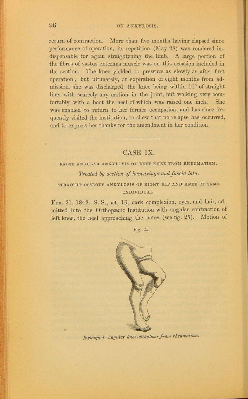 return of contraction. More than five months having elapsed since performance of operation, its repetition (May 28) was rendered in- dispensable for again straightening the limb. A large portion of the fibres of vastus externus muscle was on this occasion included in the section. The knee yielded to pressure as slowly as after first operation; but ultimately, at expiration of eight months from ad- mission, she was discharged, the knee being within 10° of straight line, with scarcely any motion in the joint, but walking very com- fortably with a boot the heel of which was raised one inch. She was enabled to return to her former occupation, and has since fre- quently visited the institution, to shew that no relapse has occurred, and to express her thanks for the amendment in her condition. FALSE ANGULAR ANKYLOSIS OF LEFT KNEE FROM RHEUMATISM. Treated by section of hamstrings and fascia lata. STRAIGHT OSSEOUS ANKYLOSIS OF RIGHT HIP AND KNEE OF SAME INDIVIDUAL. Feb. 21, 1842. S. S., set. 16, dark complexion, eyes, and hair, ad- mitted into the Orthopsedic Institution with angular contraction of left knee, the heel approaching the nates (see fig. 25). Motion of Fig. 25. CASE IX. Incomplete angular knee-ankylosis from rheumatism.