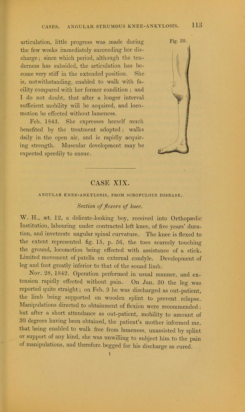 articulation, little progress was made during the few weeks immediately succeeding her dis- charge ; since which period, although the ten- derness has subsided, the articulation has be- come very stiff in the extended position. She is, notwithstanding, enabled to walk with fa- cihty compared with her former condition ; and I do not doubt, that after a longer interval sufficient mobility will be acquired, and loco- motion be effected without lameness. Feb. 1843. She expresses herself much benefited by the treatment adopted; walks daily in the open air, and is rapidly acquir- ing strength. Muscular development may be expected speedily to ensue. CASE XIX. ANGULAR KNEE-ANKYLOSIS, FROM SCROFULOUS DISEASE. Section of flexors of knee. W. H., set. 12, a delicate-looking boy, received into Orthopaedic Institution, labouring under contracted left knee, of five years’ dura- tion, and inveterate angular spinal curvature. The knee is flexed to the extent represented fig. 15, p. 56, the toes scarcely touching the ground, locomotion being effected with assistance of a stick. Limited movement of patella on external condyle. Development of leg and foot greatly inferior to that of the sound limb. Nov. 28, 1842. Operation performed in usual manner, and ex- tension rapidly effected without pain. On Jan. 30 the leg was reported quite straight; on Feb. 9 he was discharged as out-patient, the limb being supported on wooden splint to prevent relapse. Manipulations directed to obtainment of flexion were recommended ; but after a short attendance as out-patient, mobility to amount of 30 degrees having been obtained, the patient’s mother informed me, that being enabled to walk free from lameness, unassisted by splint or support of any kind, she was unwilling to subject him to the pain of manipulations, and therefore begged for his discharge as cured. I Fig. 30.