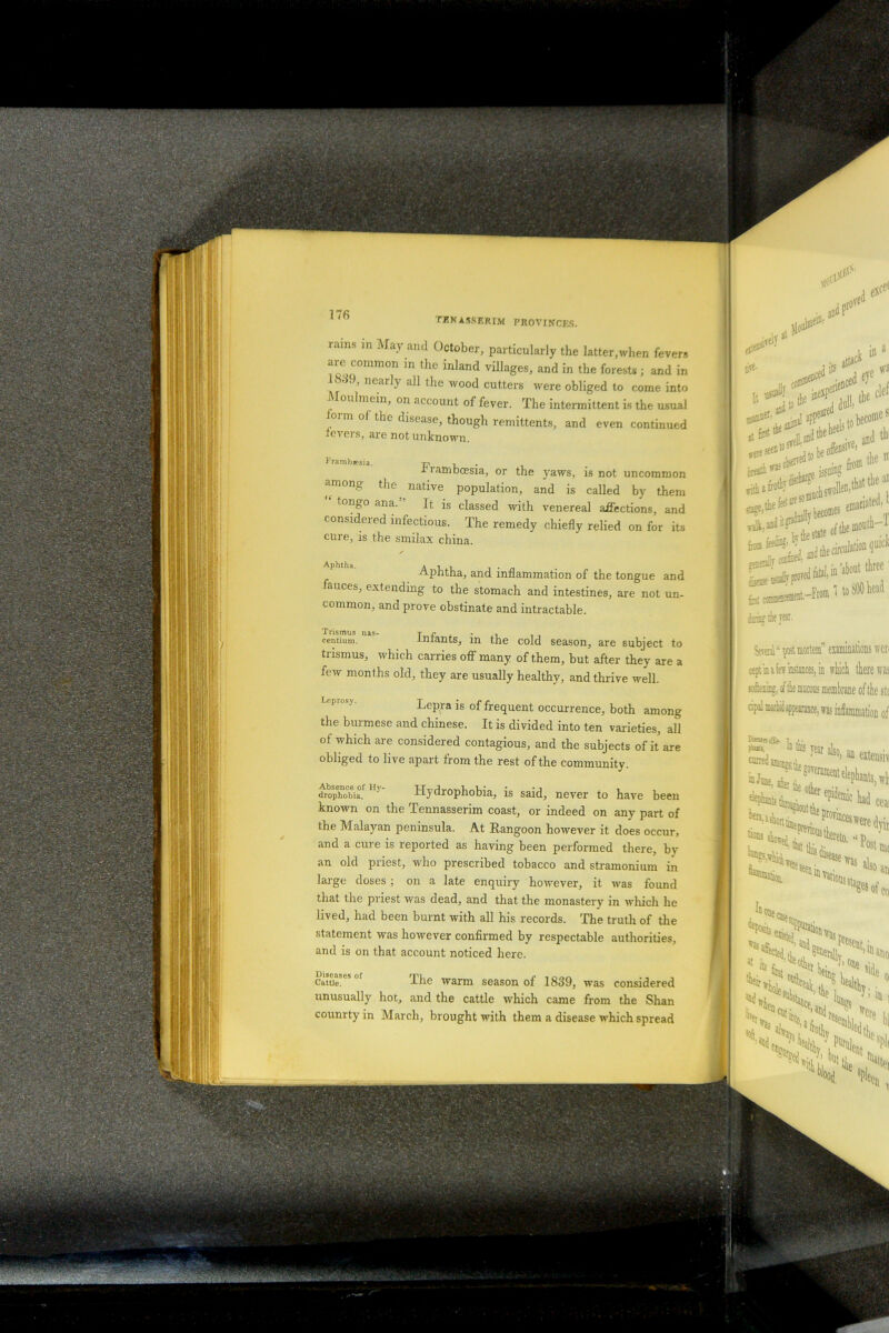 nulls m May and October, particularly the latter,when fevers are common m the inland villages, and in the forests; and in nearly all the wood cutters were obliged to come into Mouhnein, on account of fever. The intermittent is the usual ioim of the disease, though remittents, and even continued teveis, are not unknown. Frambssia. -pi . . rramboesia, or the yaws, is not uncommon among the native population, and is called by them ^ Inn rrr\ 5} T, • i ■. . . r t «-**** io i^aucu uy uieill tongo ana. It is classed with venereal affections, and considered infectious. The remedy chiefly relied on for its cure, is the smilax china. Aphtha, and inflammation of the tongue and auces, extending to the stomach and intestines, are not un- common, and prove obstinate and intractable. Trismus nas centium. Infants, in the cold season, are subject to trismus, which carries off many of them, but after they are a few months old, they are usually healthy, and thrive well. Lepra is of frequent occurrence, both among the burmese and Chinese. It is divided into ten varieties, all of which are considered contagious, and the subjects of it are obliged to live apart from the rest of the community. tirophobia, Hydrophobia, is said, never to have been known on the Tennasserim coast, or indeed on any part of the Malayan peninsula. At Rangoon however it does occur, and a cure is reported as having been performed there, by an old priest, who prescribed tobacco and stramonium in large doses; on a late enquiry however, it was found that the priest was dead, and that the monastery in which he lived, had been burnt with all his records. The truth of the statement was however confirmed by respectable authorities, and is on that account noticed here. Diseases of Cattle. The warm season of 1839, was considered unusually hot, and the cattle which came from the Shan counrty in March, brought with them a disease which spread J its * *! in a i II the *' ***&4*t |.’bec«»tS i t-’ orallybec°®es eDiaCia. y fo, coiamaiceiiient-From i to bOO Kead staged & s* va]k- and i: ^ imi the eea. SevaBl “ poit moTtem” examine cept in a iexr instances, in which softening, of tie aims membrane cipal morbidappearance, was inflam pom, in tins yen j1SOj W’liWr '“'^prtntu tions Vasafiecw 1 genets K Ha* C* ■■ >«*