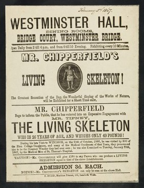 [Undated, illustrated handbill (February 1867?) advertising an appearance at Westminster Hall by Robert Tipney, Mr. Chipperfield's Living Skeleton, 26 years old and weighing 49 pounds. ].