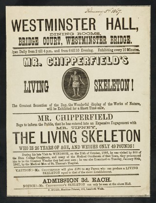 [Undated, illustrated handbill (February 1867?) advertising an appearance at Westminster Hall by Robert Tipney, Mr. Chipperfield's Living Skeleton, 26 years old and weighing 49 pounds. ].