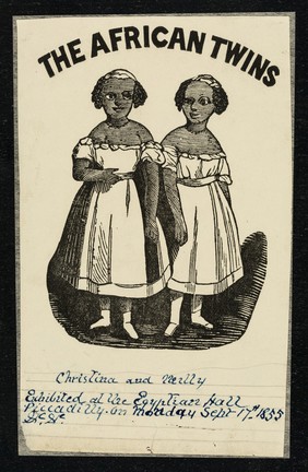 [Small print (1860?) of Christina and Millie McCoy, 'The African Twins' (or Two-Headed Nightingale) conjoined twin girls, born in North Carolina in 1851. Their mother was a slave].