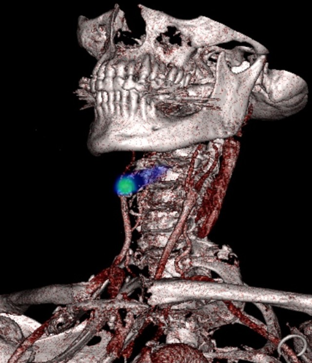 digitised image 1