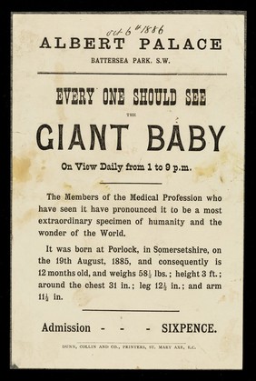 [Undated handbill (1886) advertising an appearance by a giant (3 feet tall), 1 year old baby at the Albert Palace, Battersea, London ("Every one should see the giant baby")].