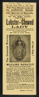 [Undated handbill (Easter week, 1898?) advertising an exhibition of Madame Babault, the real Lobster-Clawed Lady, with hand and feet deformities approximating lobster / crab claws].