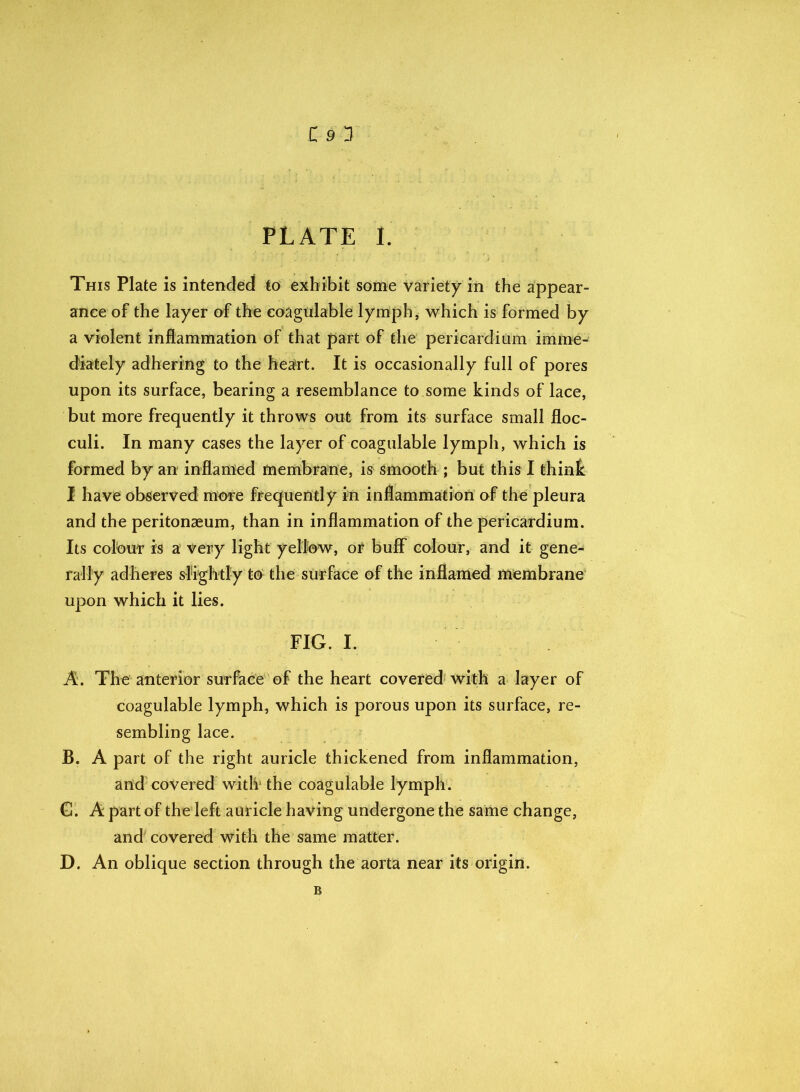 PLATE I. This Plate is intended to exhibit some variety in the appear- ance of the layer of the coagulable lymph, which is formed by a violent inflammation of that part of the pericardium imme- diately adhering to the hea-rt. It is occasionally full of pores upon its surface, bearing a resemblance to some kinds of lace, but more frequently it throws out from its surface small floc- culi. In many cases the layer of coagulable lymph, which is formed by an inflamed membrane, is smooth ; but this I think I have observed more frequently in inflammation of the pleura and the peritonaeum, than in inflammation of the pericardium. Its colour is a very light yellow, or buff colour, and it gene- rally adheres slightly to the surface of the inflamed membrane upon which it lies. FIG. I. A. The anterior surface of the heart covered with a layer of coagulable lymph, which is porous upon its surface, re- sembling lace. B. A part of the right auricle thickened from inflammation, and covered with the coagulable lymph. G. A part of the left auricle having undergone the same change, and covered with the same matter. D. An oblique section through the aorta near its origin. B