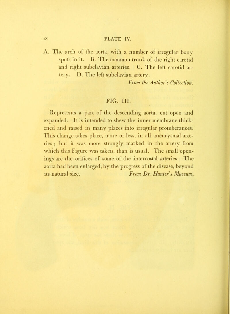 A. The arch of the aorta, with a number of irregular bony spots in it. B. The common trunk of the right carotid and right subclavian arteries. C. The left carotid ar- tery. D. The left subclavian artery. From the Author s Collection. FIG. III. Represents a part of the descending aorta, cut open and expanded. It is intended to shew the inner membrane thick- ened and raised in many places into irregular protuberances. This change takes place, more or less, in all aneurysmal arte- ries ; but it was more strongly marked in the artery from which this Figure was taken, than is usual. The small open- ings are the orifices of some of the intercostal arteries. The aorta had been enlarged, by the progress of the disease, beyond its natural size. From Dr. Hunter s Museum.