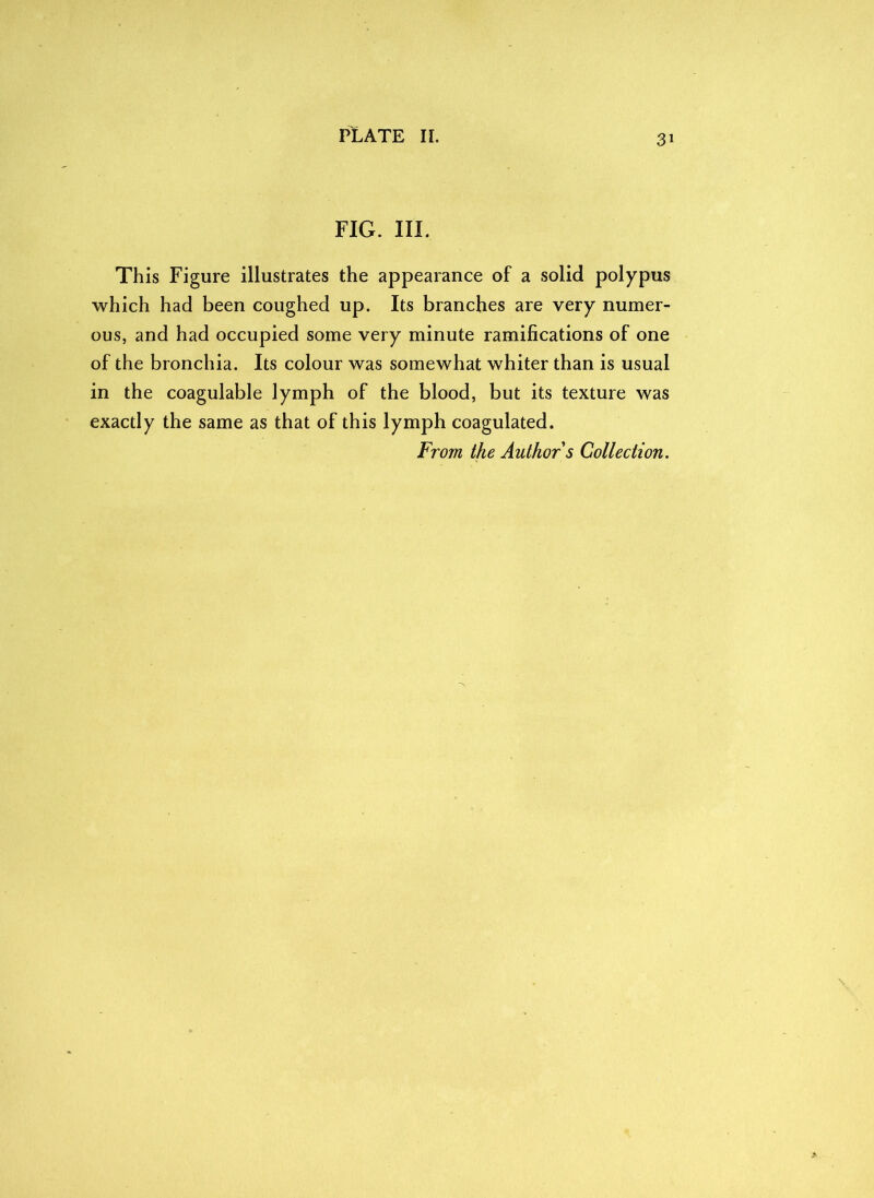 FIG. III. This Figure illustrates the appearance of a solid polypus which had been coughed up. Its branches are very numer- ous, and had occupied some very minute ramifications of one of the bronchia. Its colour was somewhat whiter than is usual in the coagulable lymph of the blood, but its texture was exactly the same as that of this lymph coagulated. From the Author s Collection.