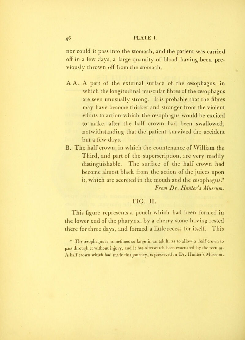 nor could it pass into the stomach, and the patient was carried off in a few days, a large quantity of blood having been pre- viously thrown off from the stomach. A A. A part of the external surface of the oesophagus, in which the longitudinal muscular fibres of the oesophagus are seen unusually strong. It is probable that the fibres may have become thicker and stronger from the violent efforts to action which the oesophagus would be excited to make, after the half crown had been swallowed, notwithstanding that the patient survived the accident but a few days. B. The half crown, in which the countenance of William the Third, and part of the superscription, are very readily distinguishable. The surface of the half crown had become almost black from the action of the juices upon it, which are secreted in the mouth and the oesophagus.* From Dr. Hunter s Museum. FIG. II. This figure represents a pouch which had been formed in the lower end of the pharynx, by a cherry stone having rested there for three days, and formed a little recess for itself . This * The oesophagus is sometimes so large in an adult, as to allow a half crown to pass through it without injury, and it has afterwards been evacuated by the rectum. A half crown which had made this journey, is preserved in Dr. Hunter’s Museum.