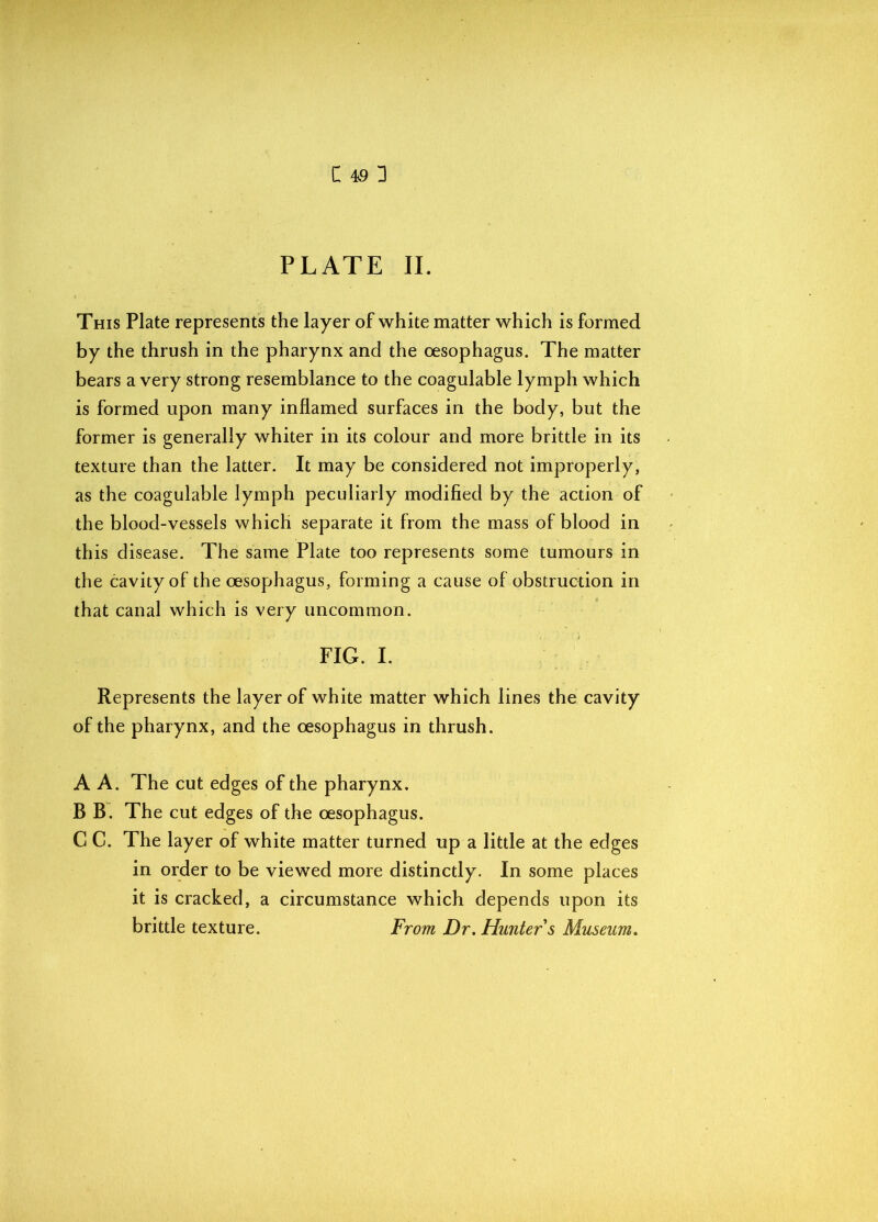PLATE II. This Plate represents the layer of white matter which is formed by the thrush in the pharynx and the oesophagus. The matter bears a very strong resemblance to the coagulable lymph which is formed upon many inflamed surfaces in the body, but the former is generally whiter in its colour and more brittle in its texture than the latter. It may be considered not improperly, as the coagulable lymph peculiarly modified by the action of the blood-vessels which separate it from the mass of blood in this disease. The same Plate too represents some tumours in the cavity of the oesophagus, forming a cause of obstruction in that canal which is very uncommon. FIG. I. Represents the layer of white matter which lines the cavity of the pharynx, and the oesophagus in thrush. A A. The cut edges of the pharynx, B B. The cut edges of the oesophagus. C C. The layer of white matter turned up a little at the edges in order to be viewed more distinctly. In some places it is cracked, a circumstance which depends upon its brittle texture. From Dr. Hunter s Museum.