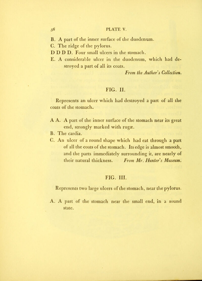 B. A part of the inner surface of the duodenum. C. The ridge of die pylorus. D D D D. Four small ulcers in the stomach. E. A considerable ulcer in the duodenum, which had de- stroyed a part of all its coats. From the Author s Collection. FIG. II. Represents an ulcer which had destroyed a part of all the coats of the stomach. A A. A part of the inner surface of the stomach near its great end, strongly marked with rugae. B. The cardia. C. An ulcer of a round shape which had eat through a part of all the coats of the stomach. Its edge is almost smooth, and the parts immediately surrounding it, are nearly of their natural thickness. From Mr. Hunter s Museum. FIG. III. Represents two large ulcers of the stomach, near the pylorus. A. A part of the stomach near the small end, in a sound state.