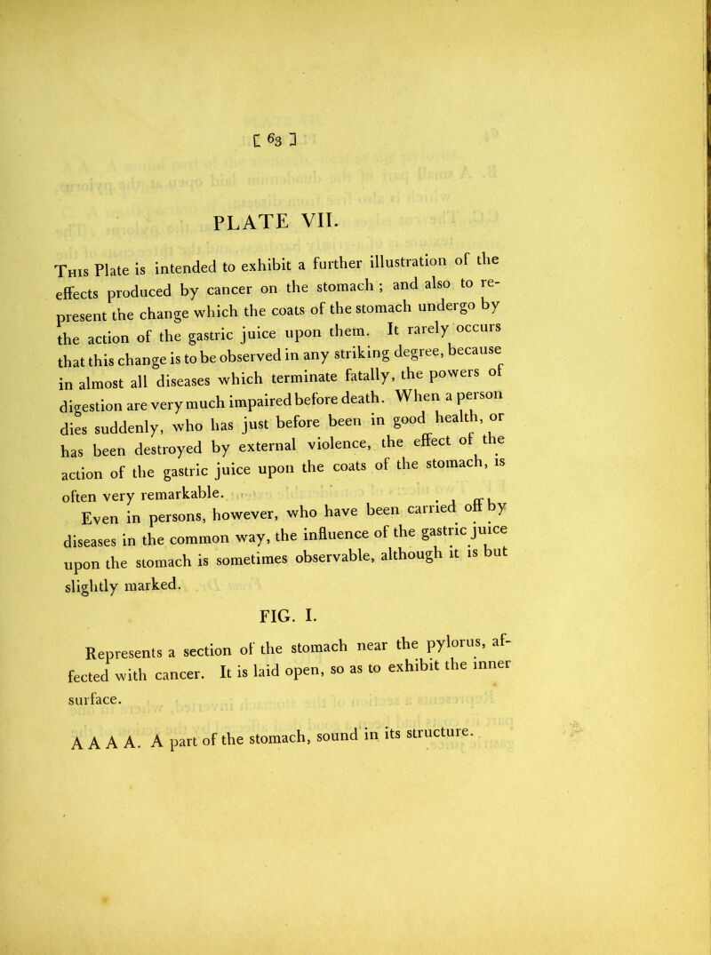 PLATE VII. This Plate is intended to exhibit a further illustration of the effects produced by cancer on the stomach ; and also to re- present the change which the coats of the stomach undergo by the action of the gastric juice upon them. It rarely occurs that this change is to be observed in any striking degree, because in almost all diseases which terminate fatally, the powers o digestion are very much impaired before death. When a peison dies suddenly, who has just before been in good healt i or has been destroyed by external violence, the effect of t e action of the gastric juice upon the coats of the stomach, is often very remarkable. Even in persons, however, who have been came o y diseases in the common way, the influence of the gastric juice upon the stomach is sometimes observable, although it is but slightly marked. FIG. I. Represents a section of the stomach near the pylorus, af- fected with cancer. It is laid open, so as to exhibit the inner surface. A A A A. A part of the stomach, sound in its structure.