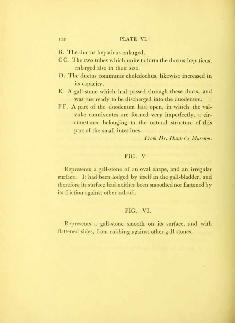 B. The ductus hepaticus enlarged. C C. The two tubes which unite to form the ductus hepaticus, enlarged also in their size. D. The ductus communis choledochus, likewise increased in its capacity. E. A gall-stone which had passed through these ducts, and was just ready to be discharged into the duodenum. FF. A part of the duodenum laid open, in which the val- vulas conniventes are formed very imperfectly, a cir- cumstance belonging to the natural structure of this part of the small intestines. From Dr% Hunter s Museum. FIG. V. Represents a gall-stone of an oval shape, and an irregular surface. It had been lodged by itself in the gall-bladder, and therefore its surface had neither been smoothed nor flattened by its friction against other calculi. FIG. VI. Represents a gall-stone smooth on its surface, and with flattened sides, from rubbing against other gall-stones.