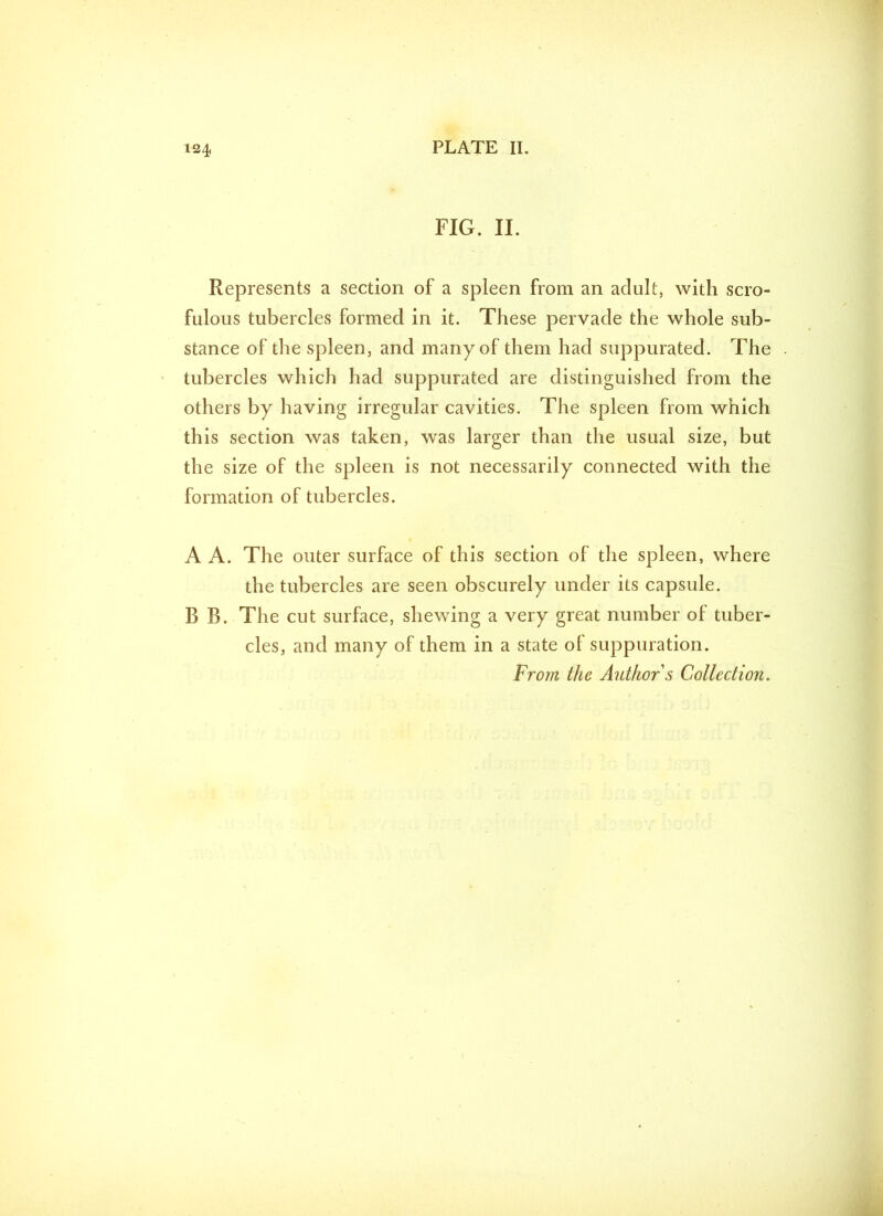 FIG. II. Represents a section of a spleen from an adult, with scro- fulous tubercles formed in it. These pervade the whole sub- stance of the spleen, and many of them had suppurated. The tubercles which had suppurated are distinguished from the others by having irregular cavities. The spleen from which this section was taken, was larger than the usual size, but the size of the spleen is not necessarily connected with the formation of tubercles. A A. The outer surface of this section of the spleen, where the tubercles are seen obscurely under its capsule. B B. The cut surface, shewing a very great number of tuber- cles, and many of them in a state of suppuration. From the Author s Collection.