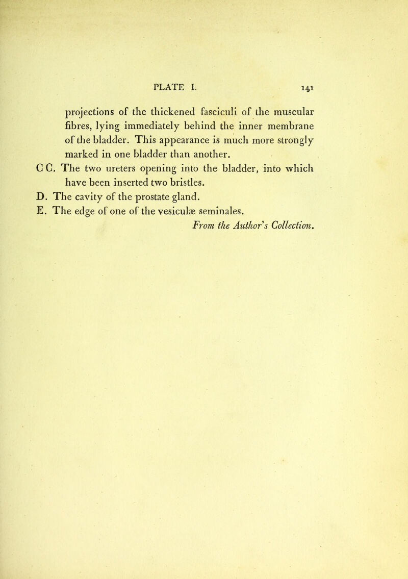 projections of the thickened fasciculi of the muscular fibres, lying immediately behind the inner membrane of the bladder. This appearance is much more strongly marked in one bladder than another. C C. The two ureters opening into the bladder, into which have been inserted two bristles. D. The cavity of the prostate gland. E. The edge of one of the vesicube seminales. From the Author s Collection.