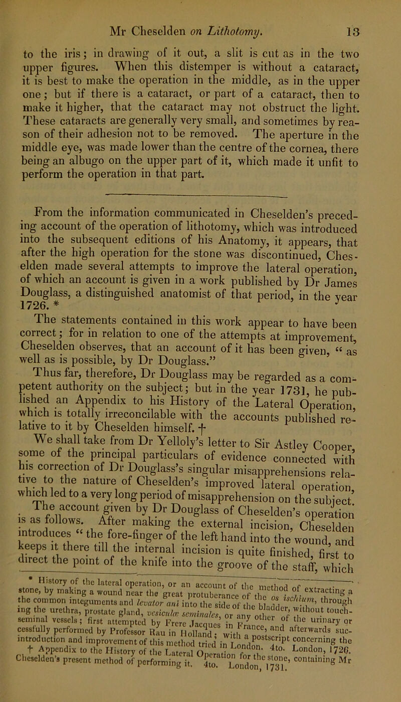 to the iris; in drawing of it out, a slit is cut as in the two upper figures. When this distemper is without a cataract, it is best to make the operation in the middle, as in the upper one; but if there is a cataract, or part of a cataract, then to make it higher, that the cataract may not obstruct the light. These cataracts are generally very small, and sometimes by rea- son of their adhesion not to be removed. The aperture in the middle eye, was made lower than the centre of the cornea, there being an albugo on the upper part of it, which made it unfit to perform the operation in that part. From the information communicated in Cheselden’s preced- ing account of the operation of lithotomy, which was introduced into the subsequent editions of his Anatomy, it appears, that after the high operation for the stone was discontinued, Ches- elden made several attempts to improve the lateral operation, of which an account is given in a work published by Dr James Douglass, a distinguished anatomist of that period, in the vear 1726. * r j j The statements contained in this w^ork appear to have been correct; for in relation to one of the attempts at improvement, Cheselden observes, that an account of it has been given “ as well as is possible, by Dr Douglass.” ’ Thus far, therefore. Dr Douglass may be regarded as a com- petent authority on the subject; but in the year 1731, he pub- lished an Appendix to his History of the Lateral Operation which is totally irreconcilable with the accounts published re- lative to It by Cheselden himself, f We shall take from Dr Yelloly’s letter to Sir Astley Cooper some of the principd particulars of evidence connected with his correction of Dr pouglass’s singular misapprehensions rela- ^^®se^en’s improved lateral operation, whmh led to a very long penod of misapprehension on the subject U I flu of Cheselden’s operation IS as follows. After making the external incision, Cheselden introduces ‘ the fore-finger of the left hand into the wound, Ld keeps It there till the internal incision is quite finished first to irect the point of the knife into the groove of the staff, which the common integuments and levator ani into the side of the bhwW tng the urethra, prostate gland, , or LJ oJi f of seminal vessels; first attempted by Frerc )aemiP« in v ‘ ° urinary or cessfully performed by ProfeLr rL in Holland- with a^nn'^lafterwards suc- introduction and improvement of this method tried ‘=“=«''nmg the t Apperiix to tho Hi.,.,, of ,l,e Cheselden’s present method of performing it. 4to. Lomlon, 1