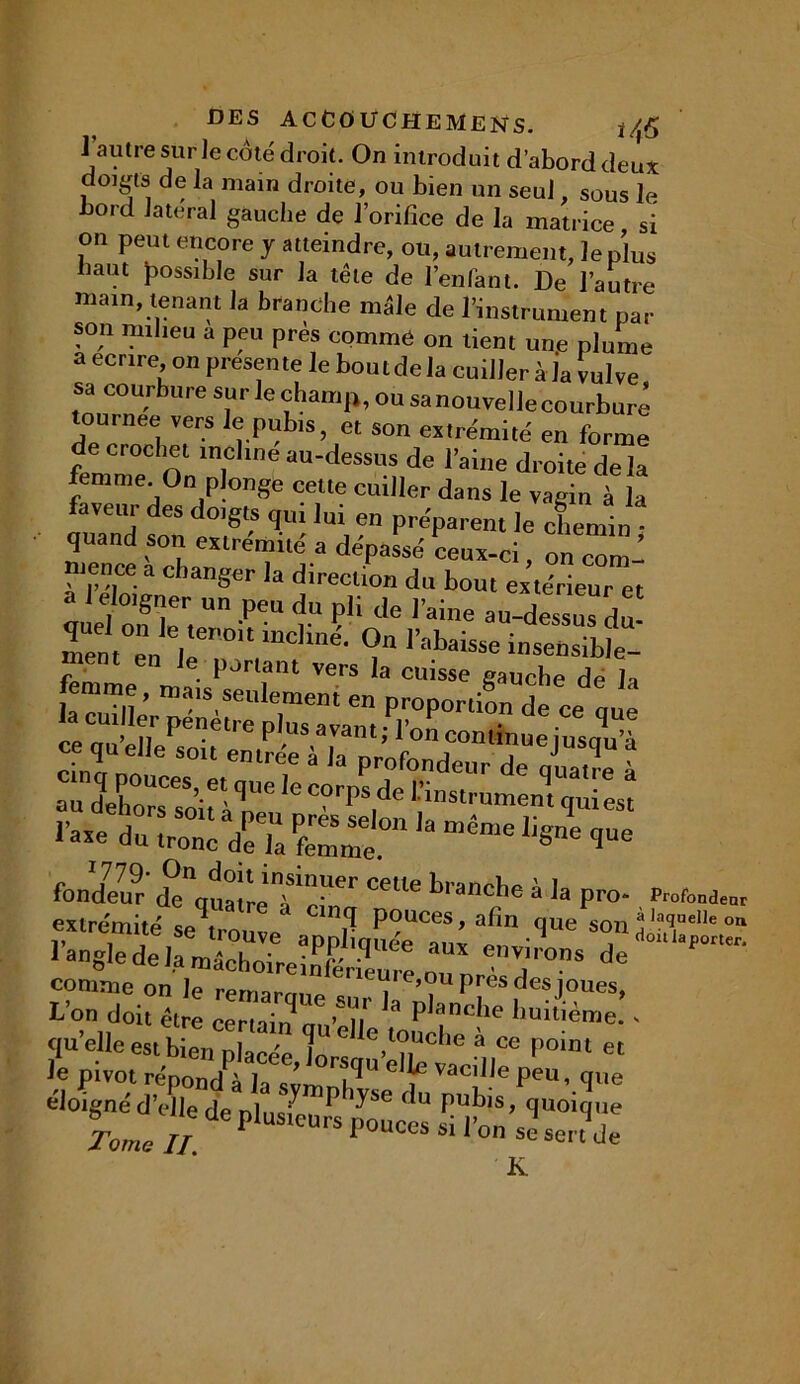 1 autre sur Je côté droit. On introduit d’abord deux doigts de la main droite, ou bien un seul, sous le bord latéral gauche de l’orifice de la matrice si on peut encore y atteindre, ou, autrement, le plus haut possible sur la tête de l’enfant. De l’autre main, tenant J a branche male de l’instrument pat- son milieu a peu près comme on tient une plume a écrire on présente le bout de la cuiller à la vulve tlCrnérbUre T ^ nhamp’ °U 83nouvel Jecourbure ournee vers le pubis, et son extrémité en forme de crochet incliné au-dessus de l’aine droite delà femme On plonge celte cuiller dans le vagin à la faveur des doigts qui lui en préparent le chemin quand son extrémité a dépassé ceux-ci, on com- mence a changer la direction du bout extérieur et : :  peu ‘!U pli de Pai“ au-dessus du- rabaisse r • P vers la cuisse ffauche de la “««.seulement en proportion de ce que fondeu? de quatreT*!^1^ ^, anc^e a Pro“ , Profondeur extrémité se trouve P°uces> afin que son j ,aq.ueIle on l’angle de la ÆeLfc: T 'T™ à° comme on Je remarque c “le>ou près des joues, L’on doit être certair?™ » n* 3 P anc^le huitième. - quelle est bienVelle,t°uch« à ce point et le P-ot ^ vacille p'e„, t,„e éloigné d’elle de plusfetus pouces >luoi<ï'>e Tome II 1 nuccs si l on se sert de K.