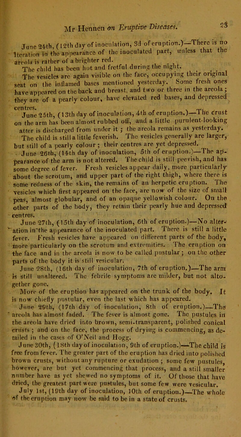 2$ June 24th, (12th day of inoculation, 3d of eruption.)—There is no Iteration in the appearance of the inoculated part, unless that the areola is rather of a brighter red. The child has been hot and fretful during the night. The vesicles are again visible on the face, occupying their original seat on the inflamed bases mentioned yesterday. Some fresh ones have appeared on the back and breast, and two or three in the areola; they are of a pearly colour, have elevated red bases, and depressed ccn tres. June 25th, (13th day of inoculation, 4th of eruption.)—The crust on the arm has been almost rubbed off, and a little purulent-looking atter is discharged from under it ; the areola remains as yesterday. The child is still a little feverish. The vesicles generally are larger, but still of a pearly colour ; their centres are yet depressed. June 26th, (14th day of inoculation, 5th of eruption.)—I'he ap- pearance of the arm is not altered. The child is still peevish, and has some degree of fever. Fresh vesicles appear daily, more particularly about the scrotum, and upper part of the right thigh, where there is some redness of the skin, the remains of an herpetic eruption. 1 he vesicles which first appeared on the face, are now of the size of small peas, almost globular, and of an opaque yellowish colour. On the other parts of the body, they retain their pearly hue and depressed centres. June 27lh, (15th day of inoculation, 6th of eruption.)—No alter- ation in'the appearance of the inoculated part. There is still a little fever. Fresh vesicles have appeared on different parts of the body, more particularly on the scrotum and extremities. The eruption on the face and in the areola is now to be called pustular; on the other parts of the body it is still vesicular. June 28th, (16th day of inoculation, 7th of eruption.)—The arm is still unaltered. The febrile symptoms are milder, but not alto- gether gone. More of the eruption has appeared on the trunk of the body. It is now chiefly pustular, even the last which has appeared. June 29th, (17th day of inoculation, 8th of eruption.)—The areola has almost faded. The fever is almost gone. The pustules irt the areola have dried into brown, semi-transparent, polished conical crusts ; and on the face, the process of drying is commencing, as de- tailed in the cases of O’Neil and Hogg. June 30th, (18th day of inoculation, 9th of eruption.)—The child is free from fever. The greater part of the eruption has dried into polished brown crusts, without any rupture or exudation ; some few pustules, however, are but yet commencing that process, and a still smaller number have as yet shewed no symptoms of it. Of those that have dried, the greatest part were pustules, but some few were vesicular. July 1st, (19th day of inoculation, 10th of eruption.)—The whole nf the eruption may now be said to be in a state of crusts.