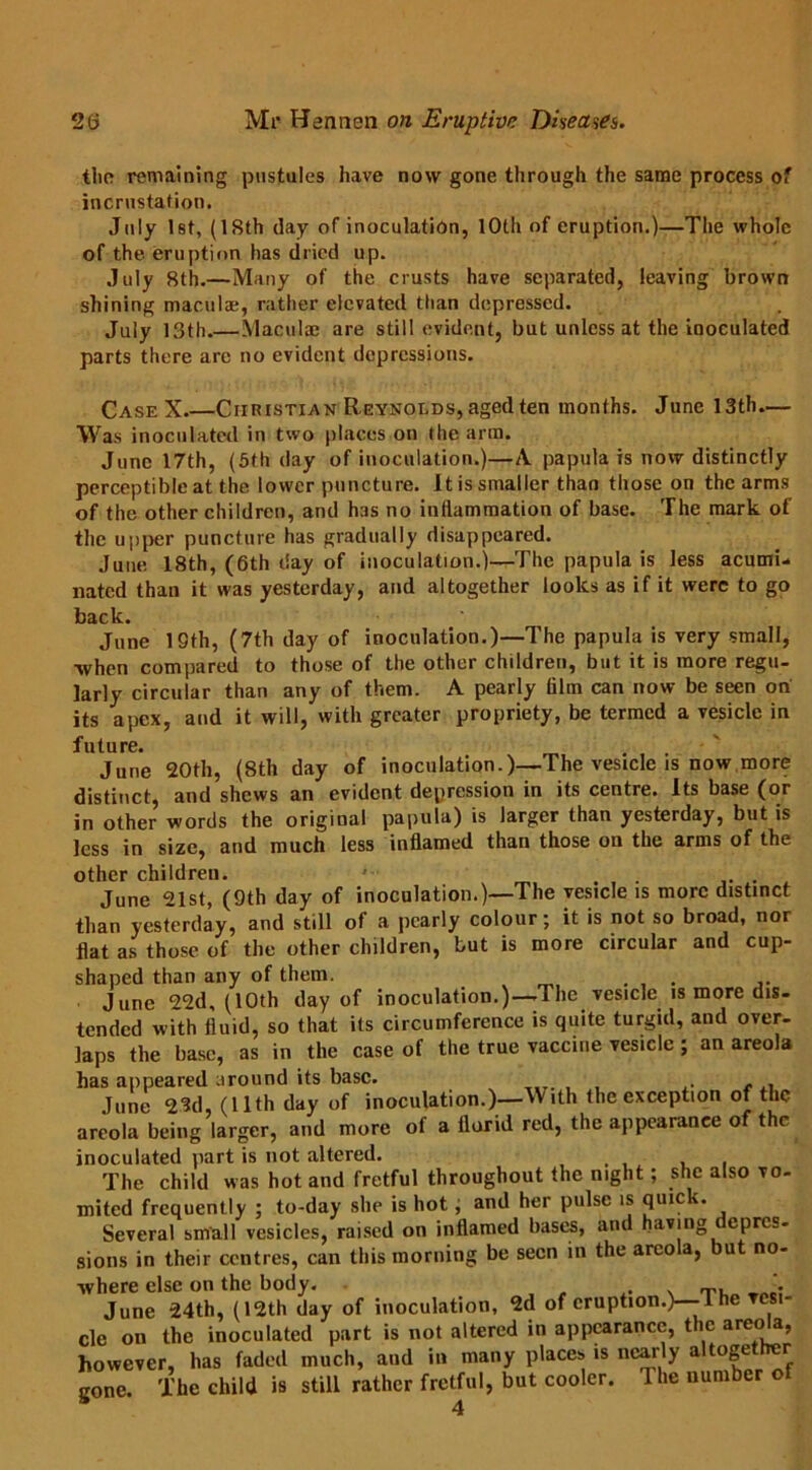tlio remaining pustules have now gone through the same process of incrustation. July 1st, (ISth clay of inoculation, 10th of eruption.)—The whole of the eruption has dried up. July 8th.—Many of the crusts have separated, leaving brown shining maculae, rather elevated than depressed. July 13th.—Maculae are still evident, but unless at the inoculated parts there arc no evident depressions. Case X.—Christian Reynolds, aged ten months. June 13th.— Was inoculated in two places on the arm. June 17th, (5th day of inoculation.)—A. papula is now distinctly perceptible at the lower puncture. It is smaller than those on the arms of the other children, and has no inflammation of base. The mark of the upper puncture has gradually disappeared. June 18th, (6th day of inoculation.)—The papula is less acumi- nated than it was yesterday, and altogether looks as if it were to go back. June 19th, (7th day of inoculation.)—The papula is very small, ■when compared to those of the other children, but it is more regu- larly circular than any of them. A pearly film can now be seen on its apex, and it will, with greater propriety, be termed a vesicle in future. June 20th, (8th day of inoculation.)—The vesicle is now more distinct, and shews an evident depression in its centre. Its base (or in other words the original papula) is larger than yesterday, but is less in size, and much less inflamed than those on the arms of the other children. ' . . June 21st, (9th day of inoculation.)—The vesicle is more distinct than yesterday, and still of a pearly colour; it is not so broad, nor flat as those of the other children, but is more circular and cup- shaped than any of them. . June 22d, (10th day of inoculation.)—The vesicle is more dis- tended with fluid, so that its circumference is quite turgid, and over- laps the base, as in the case of the true vaccine vesicle ; an areola has appeared around its base. ,. . . Tune 23d (11th day of inoculation.)—With the exception of the areola being larger, and more of a florid red, the appearance of the inoculated part is not altered. The child was hot and fretful throughout the night; she also vo- mited frequently ; to-day she is hot; and her pulse is quick. Several small vesicles, raised on inflamed bases, and having depres- sions in their centres, can this morning be seen in the areola, but no- where else on the body. , , „ • June 24th, (12th day of inoculation, 2d of eruption.)—-1 he vesi- cle on the inoculated part is not altered in appearance, the areola, however, has faded much, and in many places is nearly altogether gone. The child is still rather fretful, but cooler. The number of