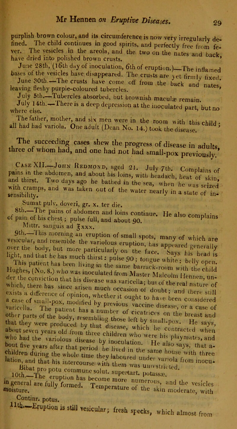 purplish brown colour, and its circumference is now very irregularly de- fined. The child continues in good spirits, and perfectly free from fe- ver. The vesicles in the areola, and the two on the nates and bict- have dried into polished brown crusts. * June 28th, (16th day of inoculation, 6th of eruption.)—The inflamed bases of the vesicles have disappeared. The crusts are yet firmlv fixed June JOlh—The crusts have come off from the back JZ leaving fleshy purple-coloured tubercles. 9 t.,i i j »i »pi . i . , lush maculae remain, whe^else. ^ * P depreSsi°n at the i,loculated part, but no 1 he father, mother and six men were in the room with this child • all had had variola. One adult (Dean No. 14.) took the disease. “ ““ ’ The succeeding cases shew the progress of disease in adults three of whom had, and one had not had small-pox previously! Case XII.—John Redmond, need <>i Ti.lv 7th n . . pains in the abdomen, and about his loins, iith headac'h, ife'at ft, and thirst. 1 wo days ago he bathed in the sea, when he was seDnd t7„sibn,7s’a w“lak™out of ,he Sumat pulv. doveri, gr. x. ter die. 8th—rhe pains of abdomen and loins continue. He also mmnl,' of pain of his chest; pulse full, and about 90. complains Mittr. sanguis ad ^xxx. 9th. This morning an eruption of small snots manv of uddni. vesicular, and resemble the variolous eruntion ’ 7 °f1wh,ch are .over the body, but more particularly on the face ^SavrhifT^I117 l.Sl,t and that he ha, much thirst: pulse 90;,o,le vvhh?. b II.  the barrack.room with the child der the conviction that his disease was varicefla ! th f 5 Un', S :‘cciDe d'~ * ^ other parts of the body, resembling those left'b) small.'S?1 ^ that they were produced hv t|iap - p<-.\. He says, yCai'S °ld lVom th«-ee children* Jhowere'histof who had the variolous disease by inoculation He dyn,ates» and bout five years after that period (pi; i o’ 8 80 sa^’s’ that a children during the whole time thev i*™ ho,,se wilh three latiom and that hi, i,.^ ttEXtSSS ta- in general le f„nvCmed? ‘^”on! the vesicles moisture. t ature of the skin moderate, with Continr. potus. lui“—Eruption is still vesicular; fresh specks, which almost from