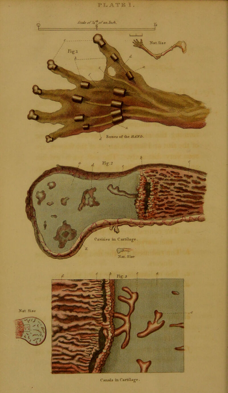 P1L. A T E II . Canals in Cartilage.