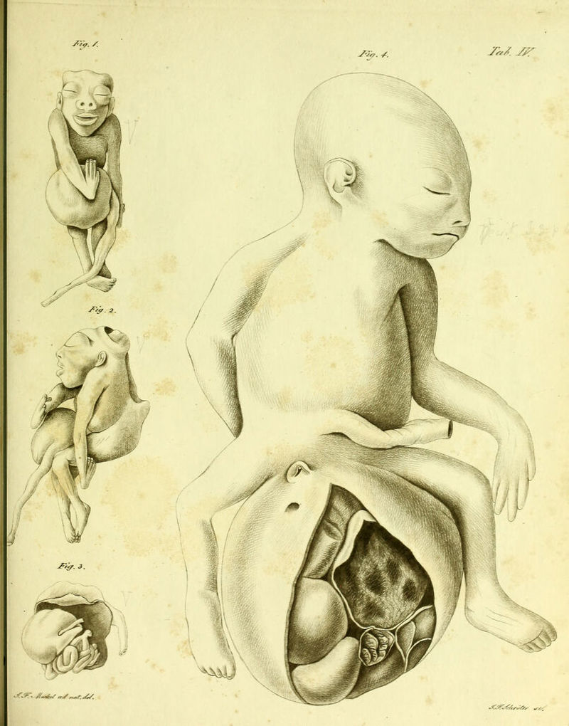 -<^57. X -7?«^. •>< Jfy. 3.